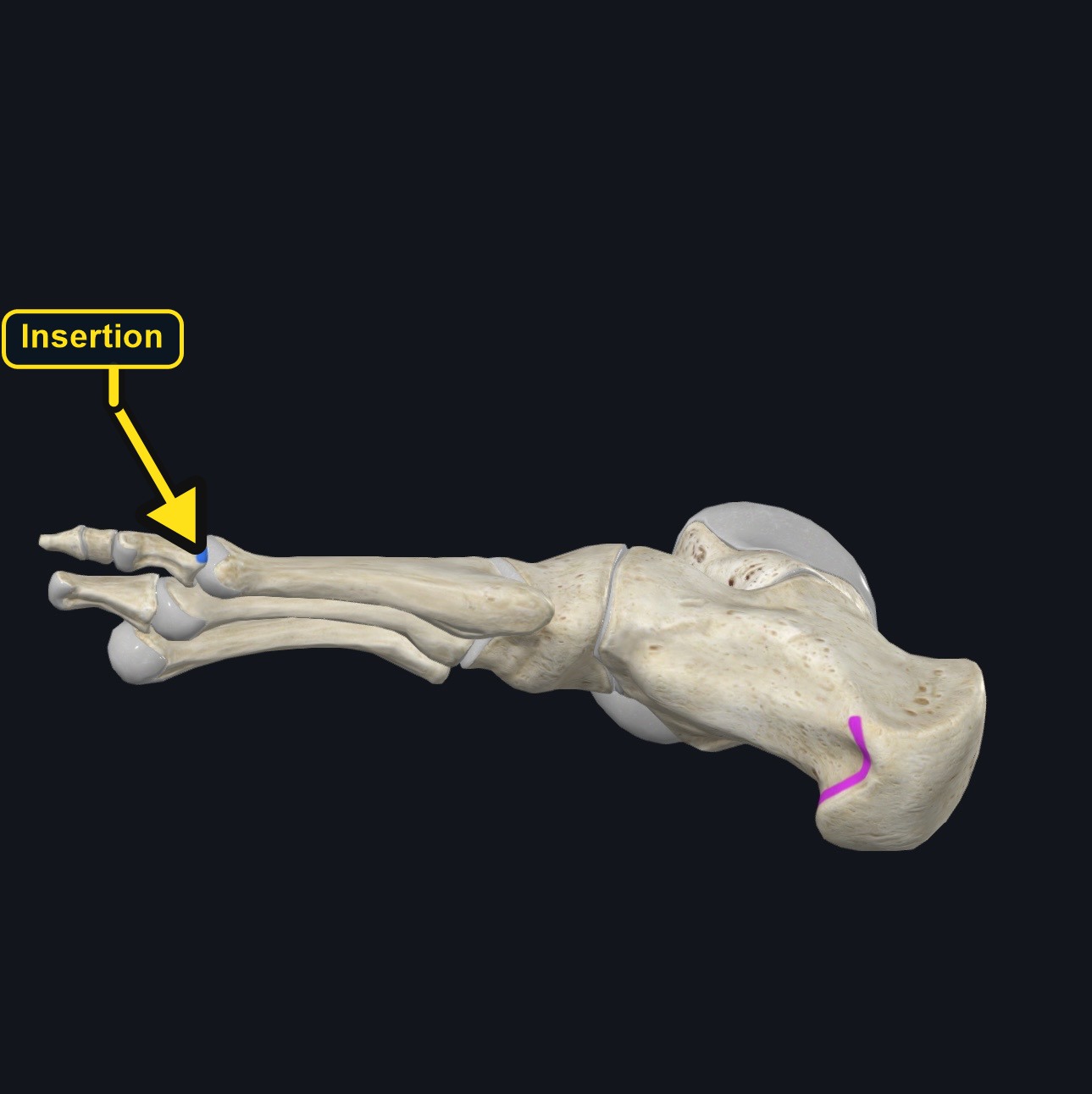 Attachment landmarks for abductor hallucis on the calcaneus and great toe (arrows and labels mark the insertion)