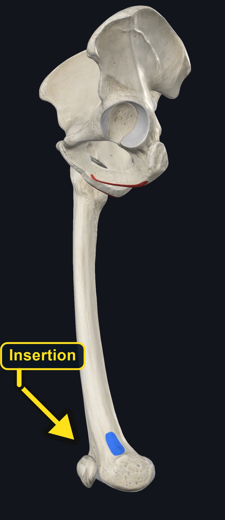 Ischiopubic ramus and adductor tubercle landmarks used for adductor magnus (arrows and labels mark the insertion)