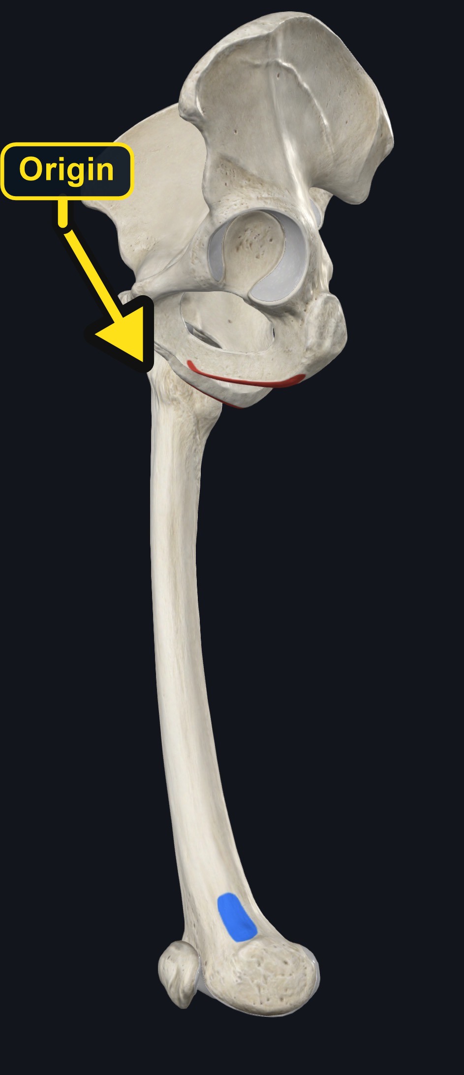 Ischiopubic ramus and adductor tubercle landmarks used for adductor magnus (arrows and labels mark the origin)
