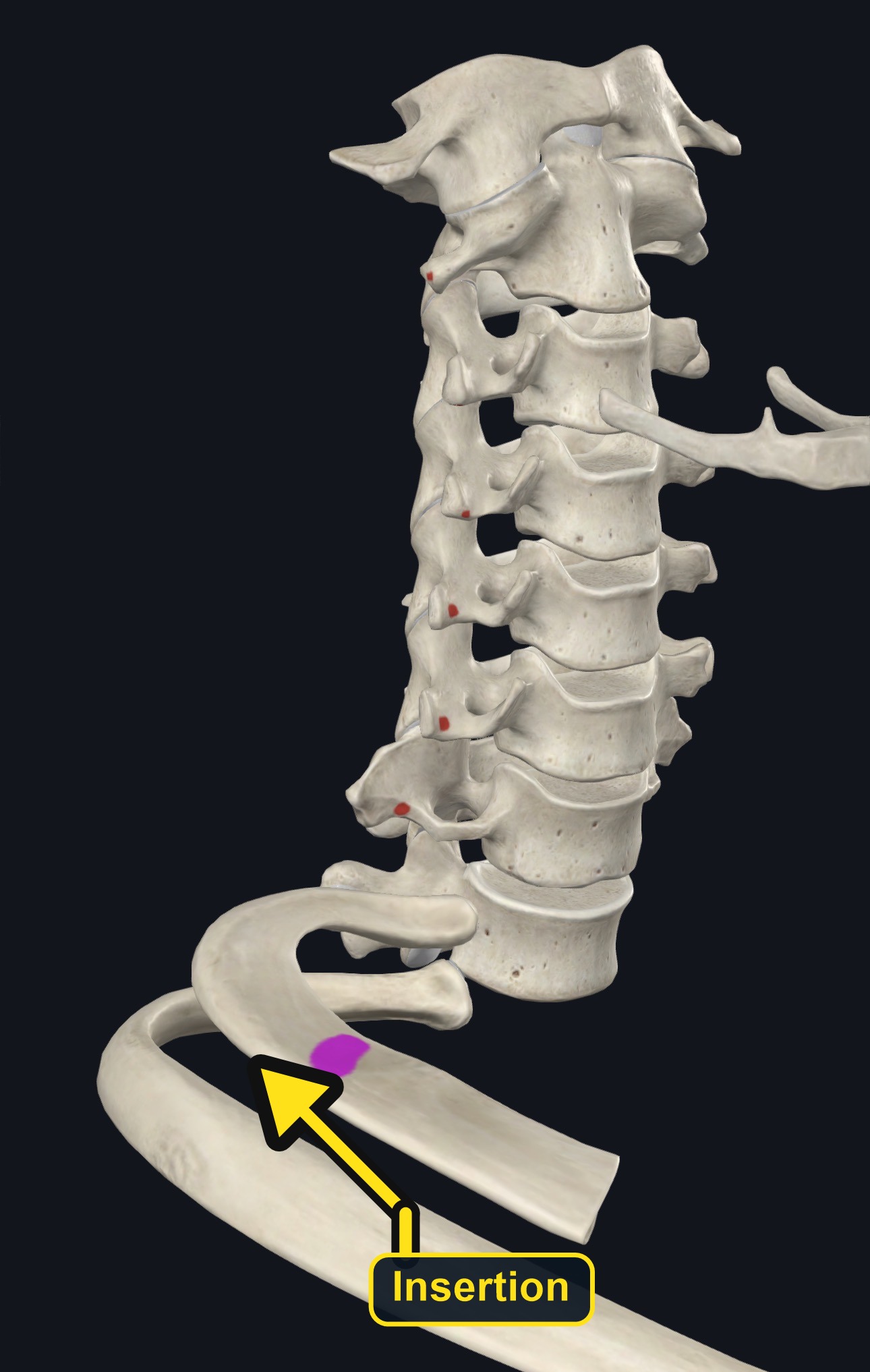 Insertion landmark of anterior scalene on the first rib (arrows and labels mark the insertion)