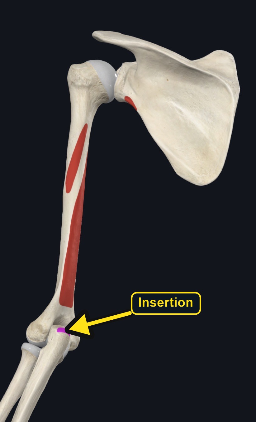 Oblique skeletal view with biceps attachment footprints colored (arrows and labels mark the insertion)