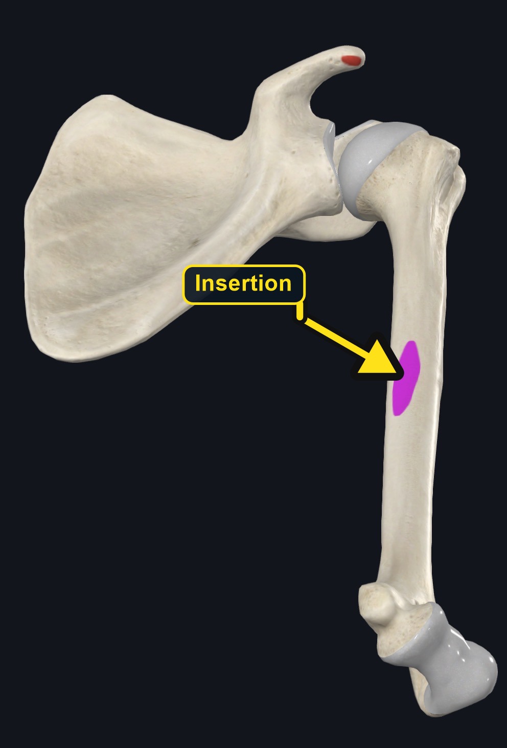 Coracoid origin and medial humeral insertion marked (arrows and labels mark the insertion)