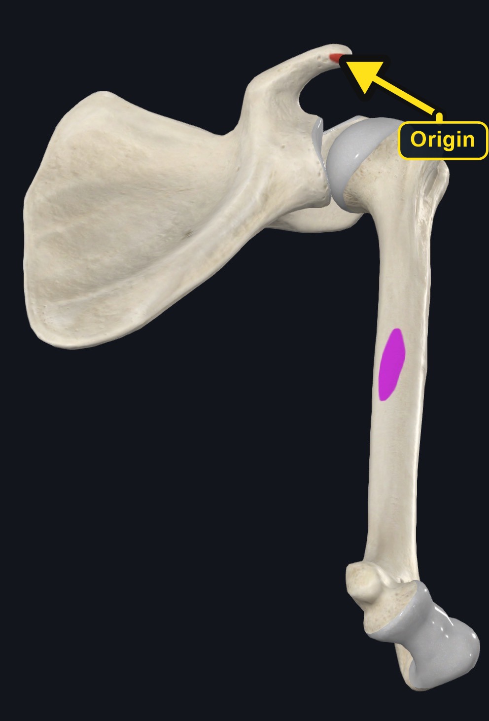 Coracoid origin and medial humeral insertion marked (arrows and labels mark the origin)