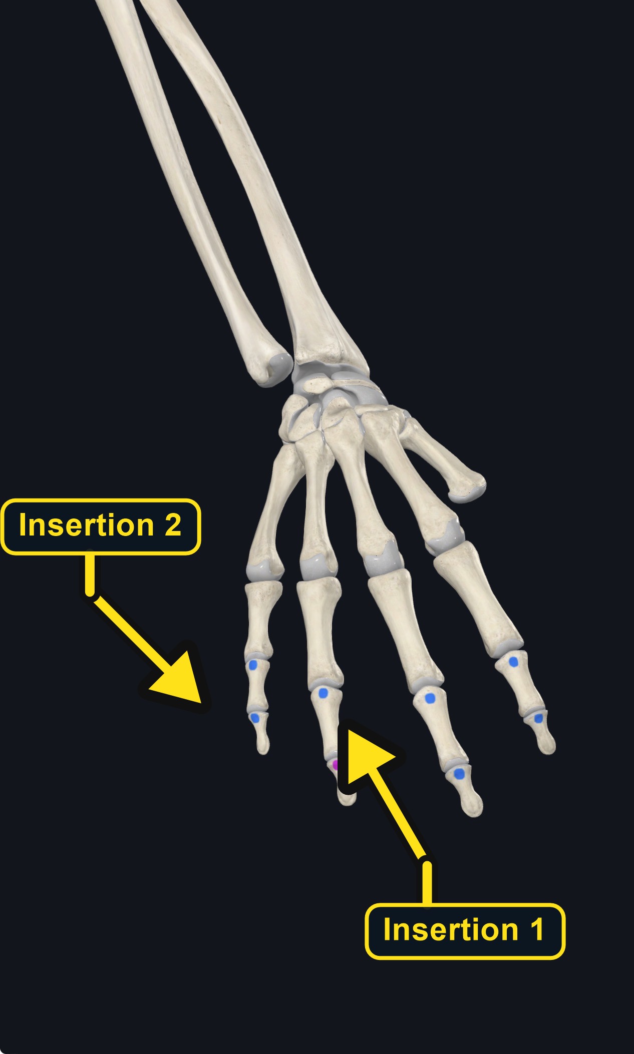 Extensor expansion insertions (arrows and labels mark the insertion)