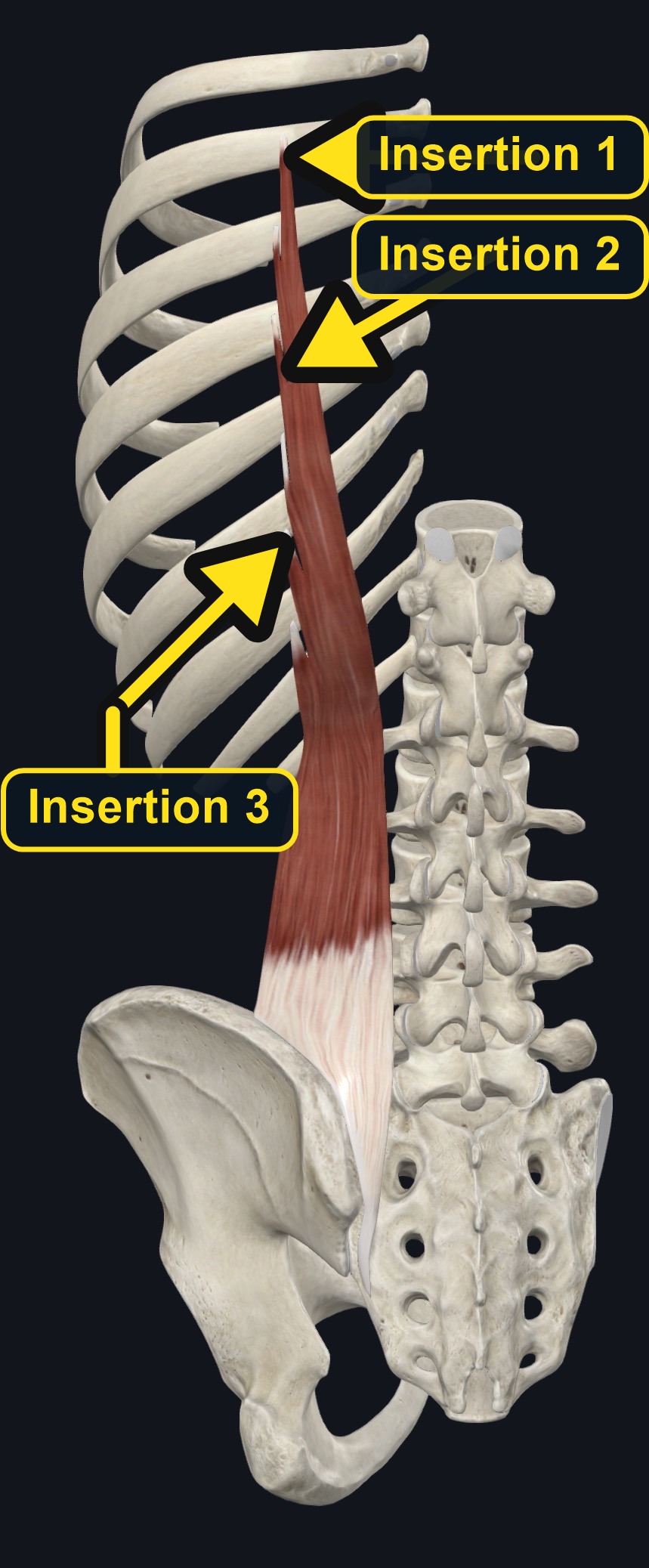Iliocostalis column of the erector spinae group beside the spine (arrows and labels mark the insertion)