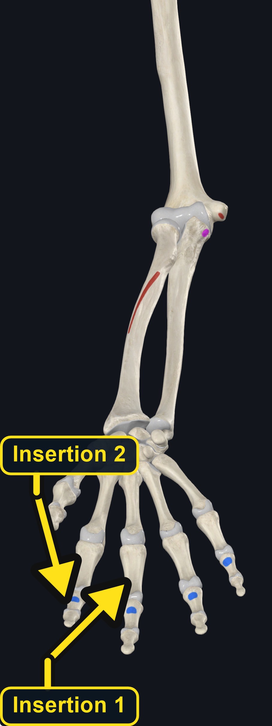 Origin and insertion landmarks of flexor digitorum profundus (arrows and labels mark the insertion)