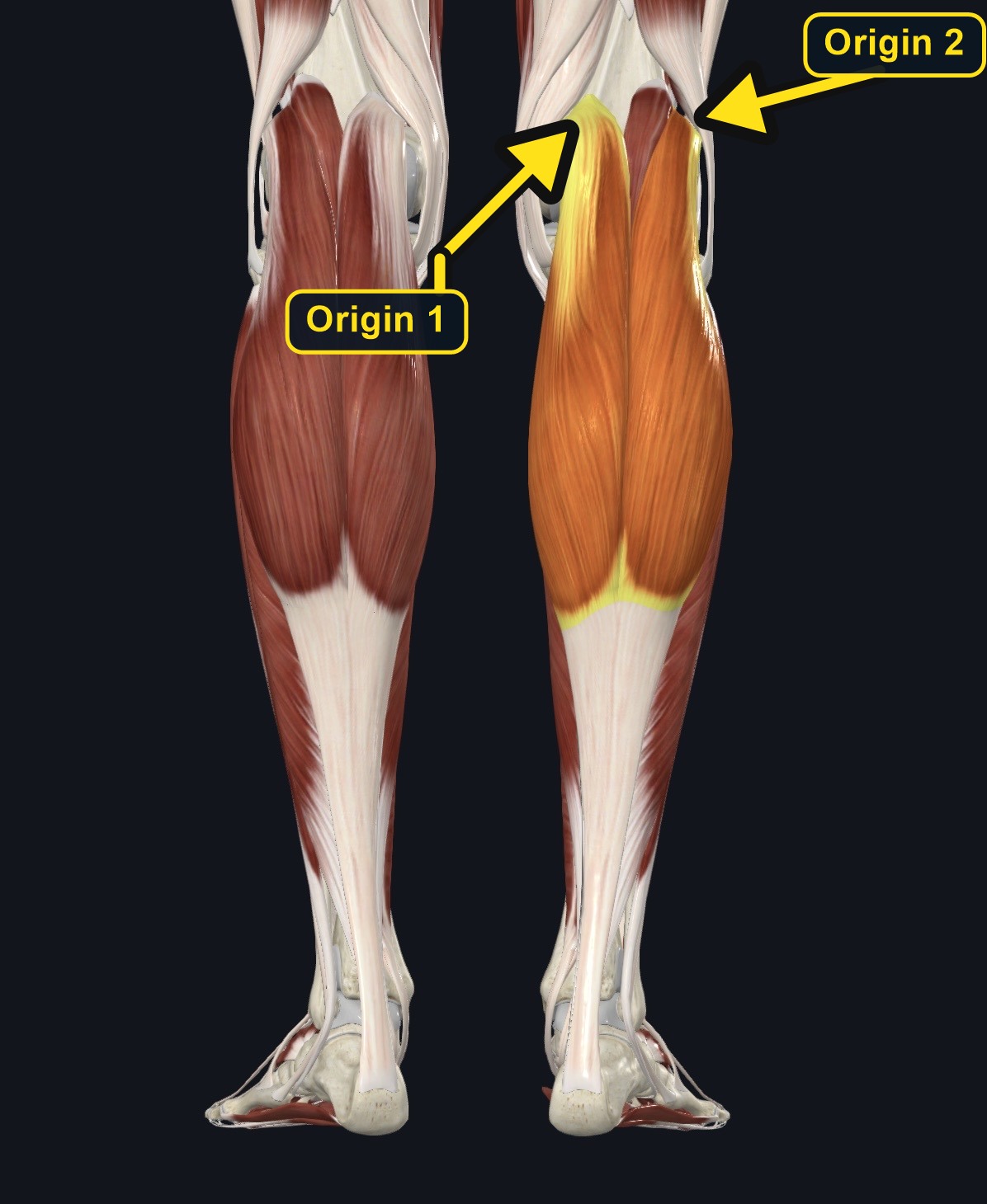 Gastrocnemius medial and lateral heads on the posterior leg (arrows and labels mark the origin)