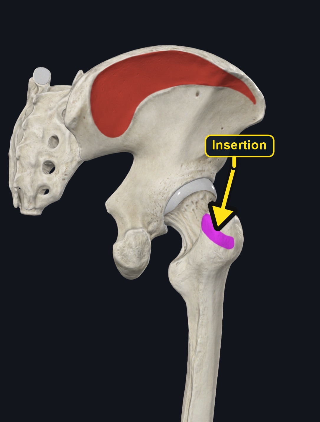 Gluteus medius attachment landmarks (arrows and labels mark the insertion)