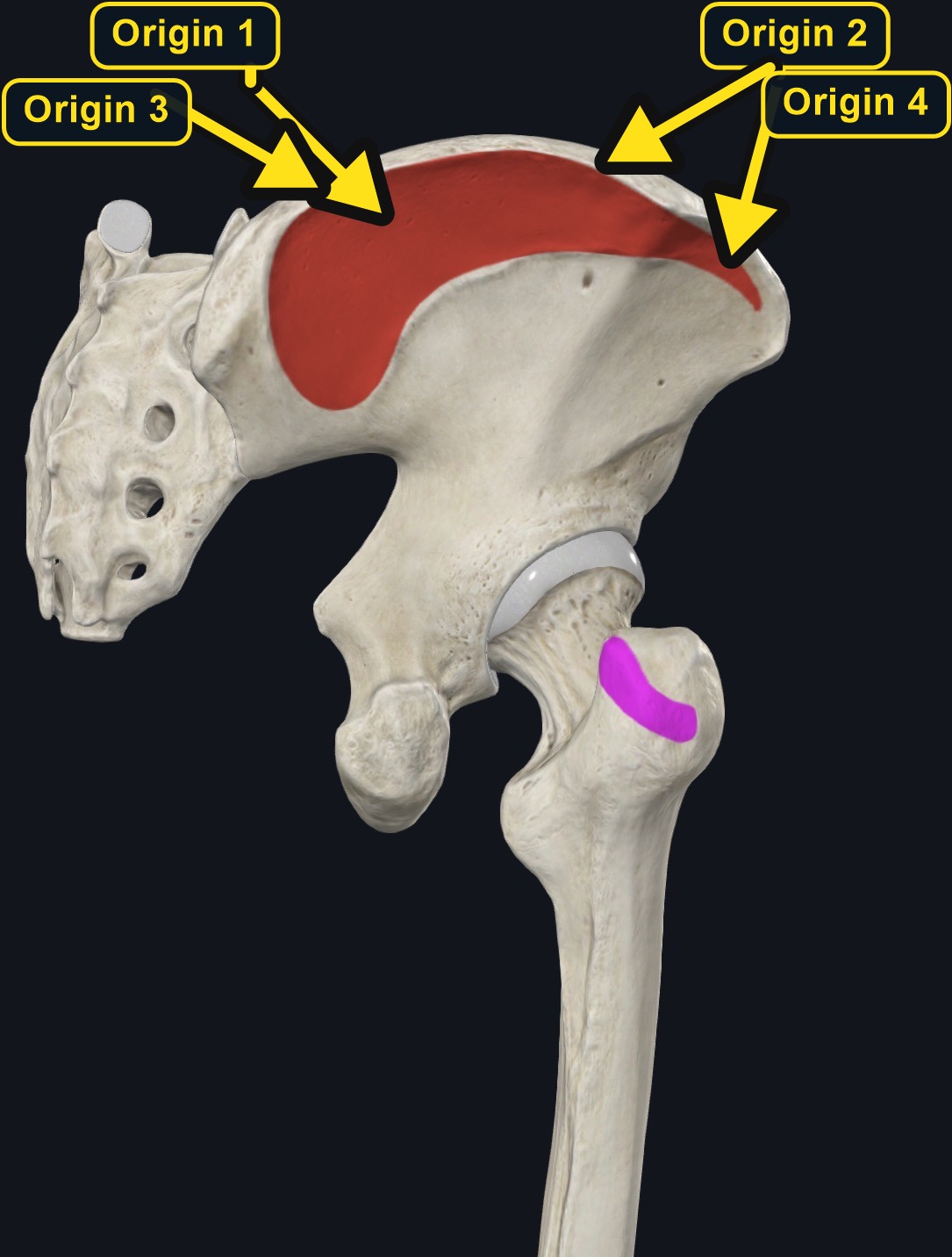 Gluteus medius attachment landmarks (arrows and labels mark the origin)