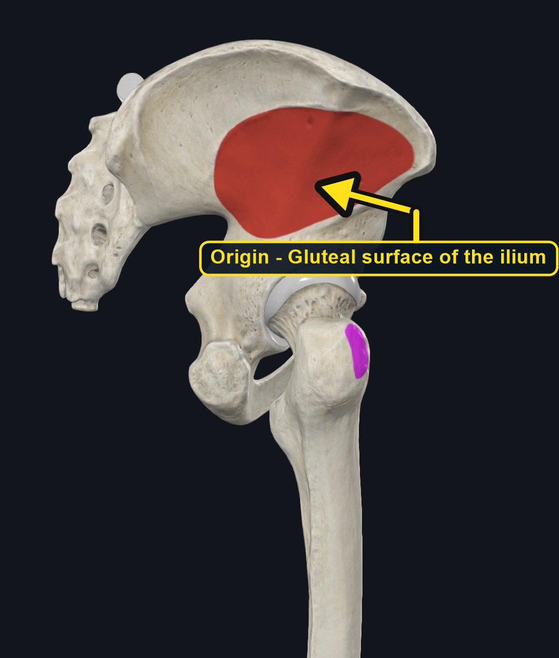 Attachment landmarks for gluteus minimus on the ilium and femur (arrows and labels mark the origin)