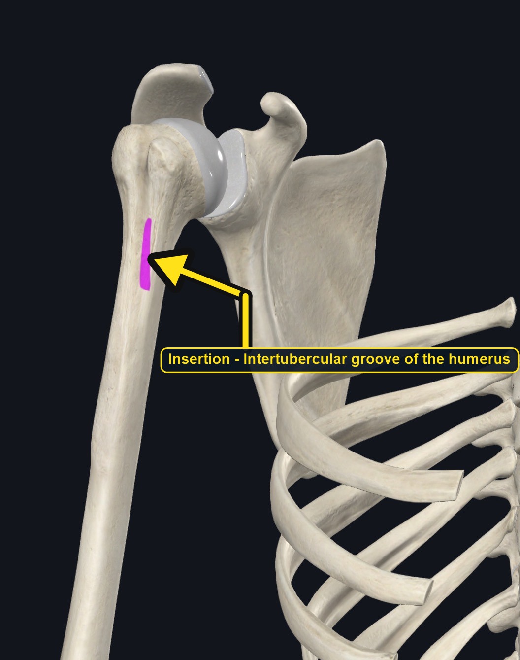 Insertion of latissimus dorsi on the humerus (arrows and labels mark the insertion)