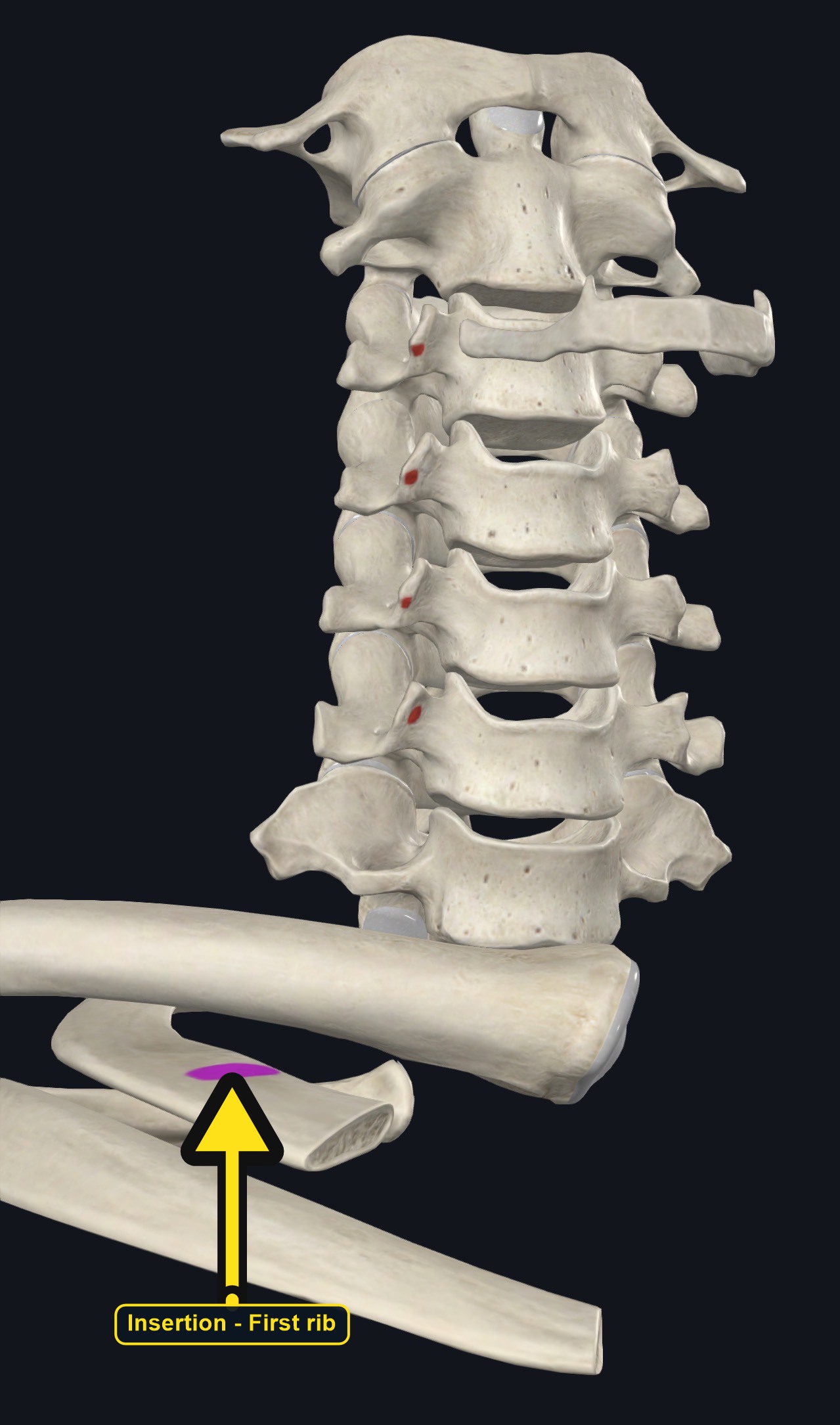 Cervical transverse process tubercles and the first rib marked as attachments (arrows and labels mark the insertion)