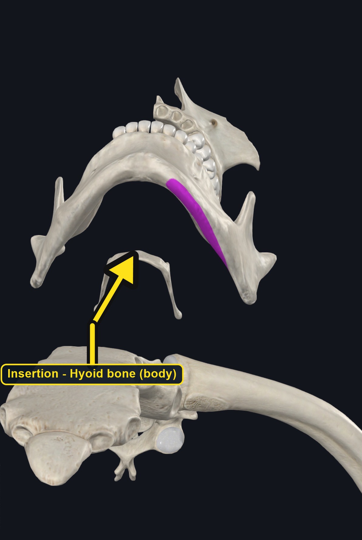 Mandible and hyoid bone with the mylohyoid line marked (arrows and labels mark the insertion)