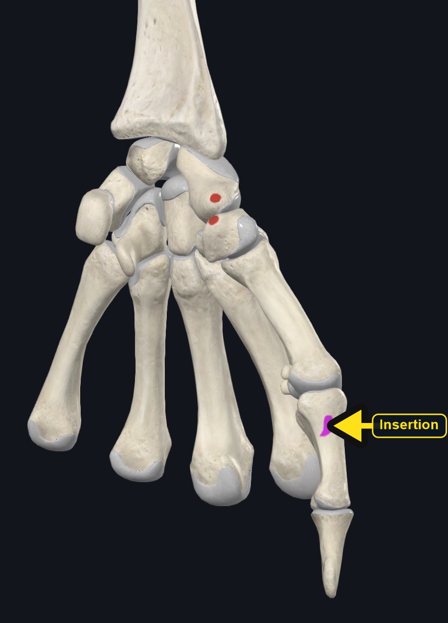 Hand bones with the attachment sites of opponens pollicis marked (arrows and labels mark the insertion)