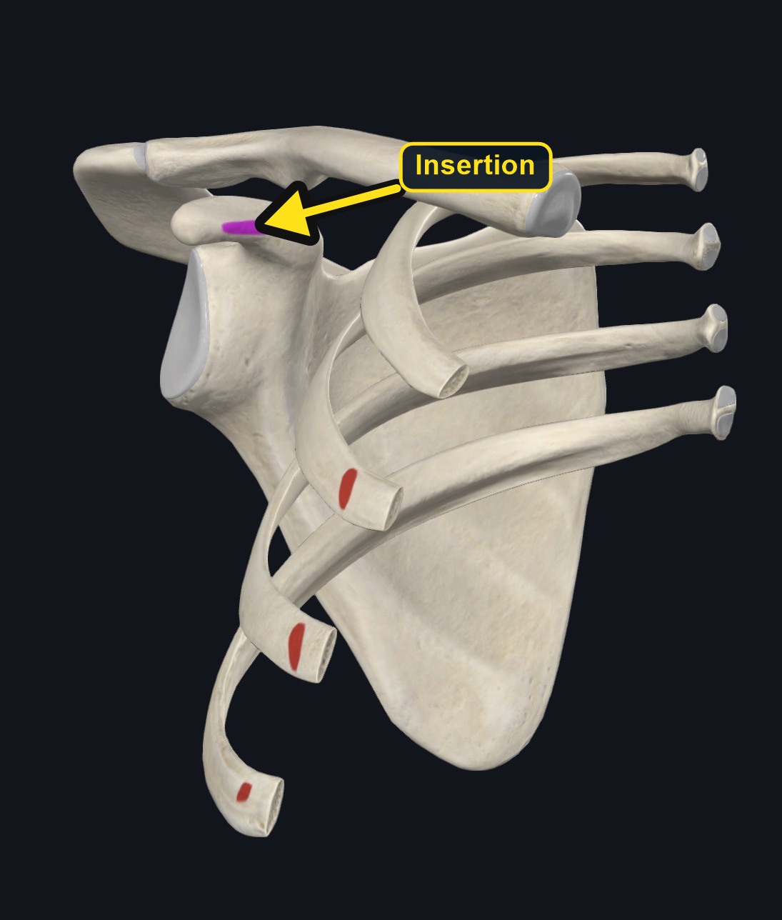 Pectoralis minor rib origins (arrows and labels mark the insertion)