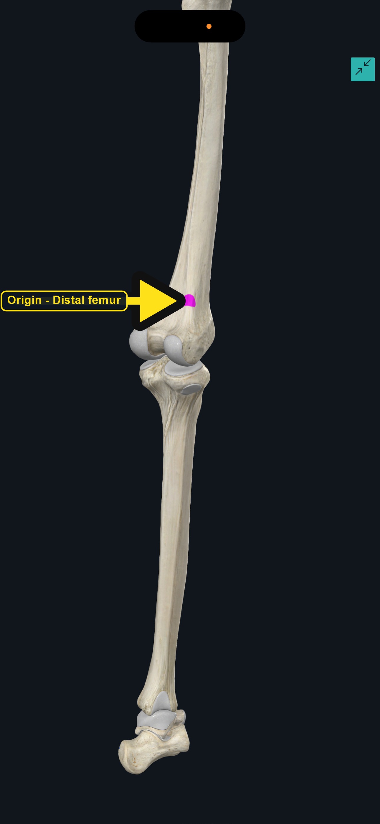Femur and knee with the origin of plantaris marked (arrows and labels mark the origin)