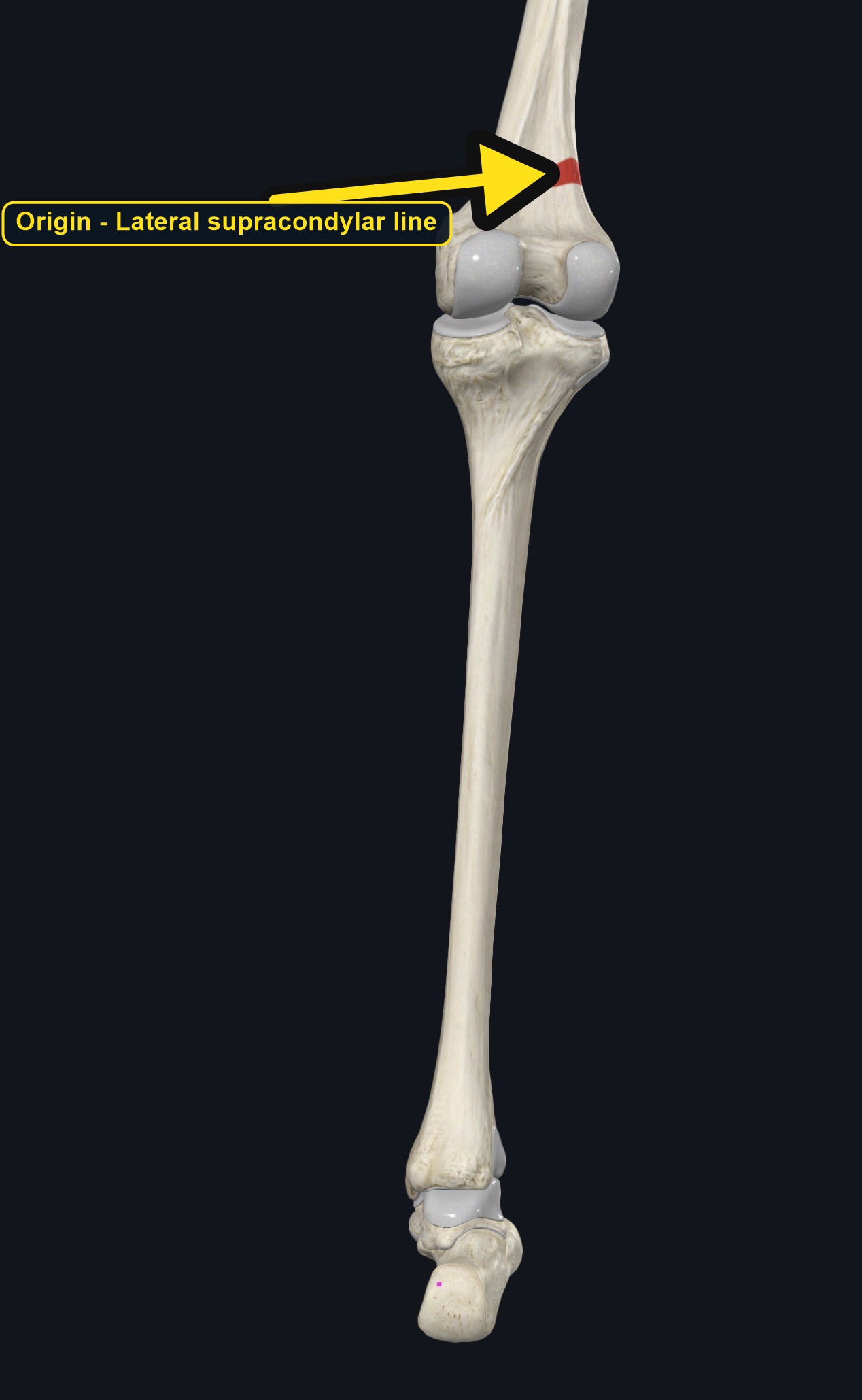 Leg bones with the femoral origin and calcaneal insertion of plantaris marked (arrows and labels mark the origin)