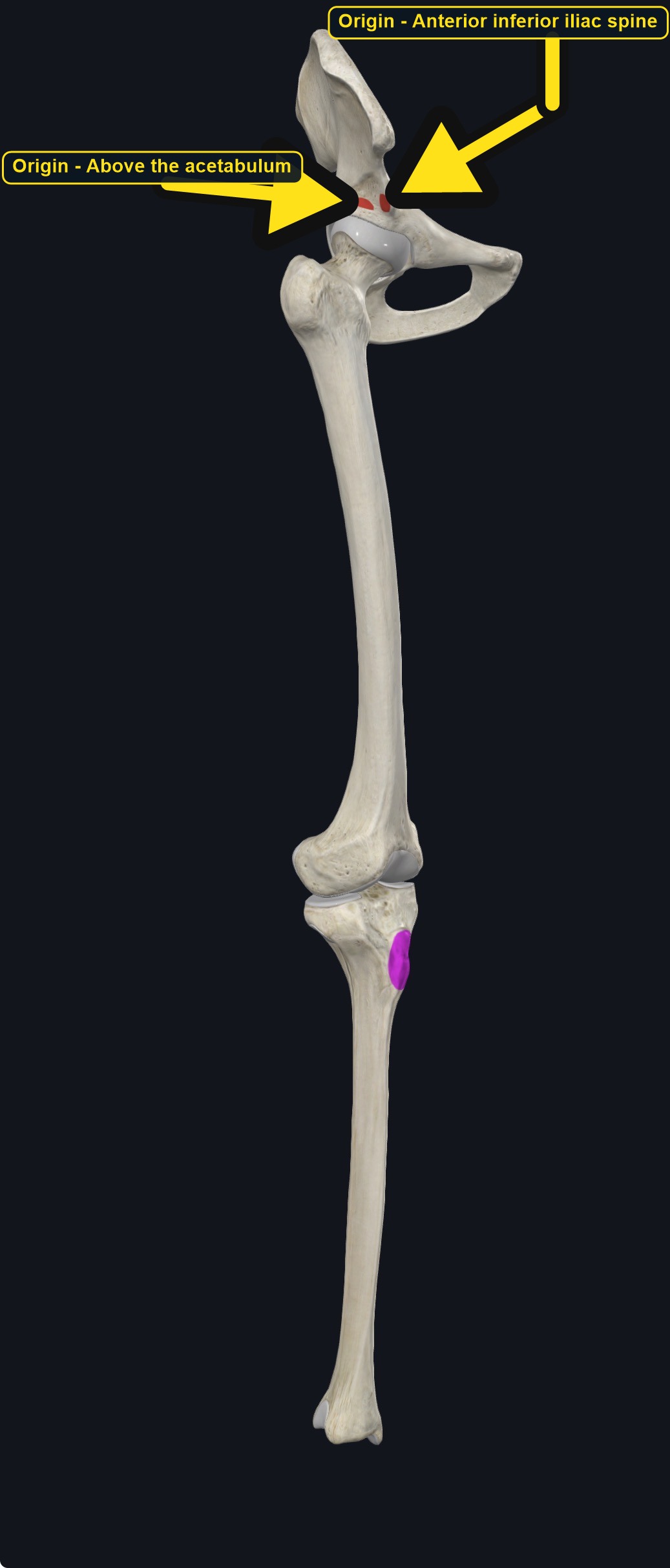 Pelvis, femur, and tibia with the attachment sites marked (arrows and labels mark the origin)