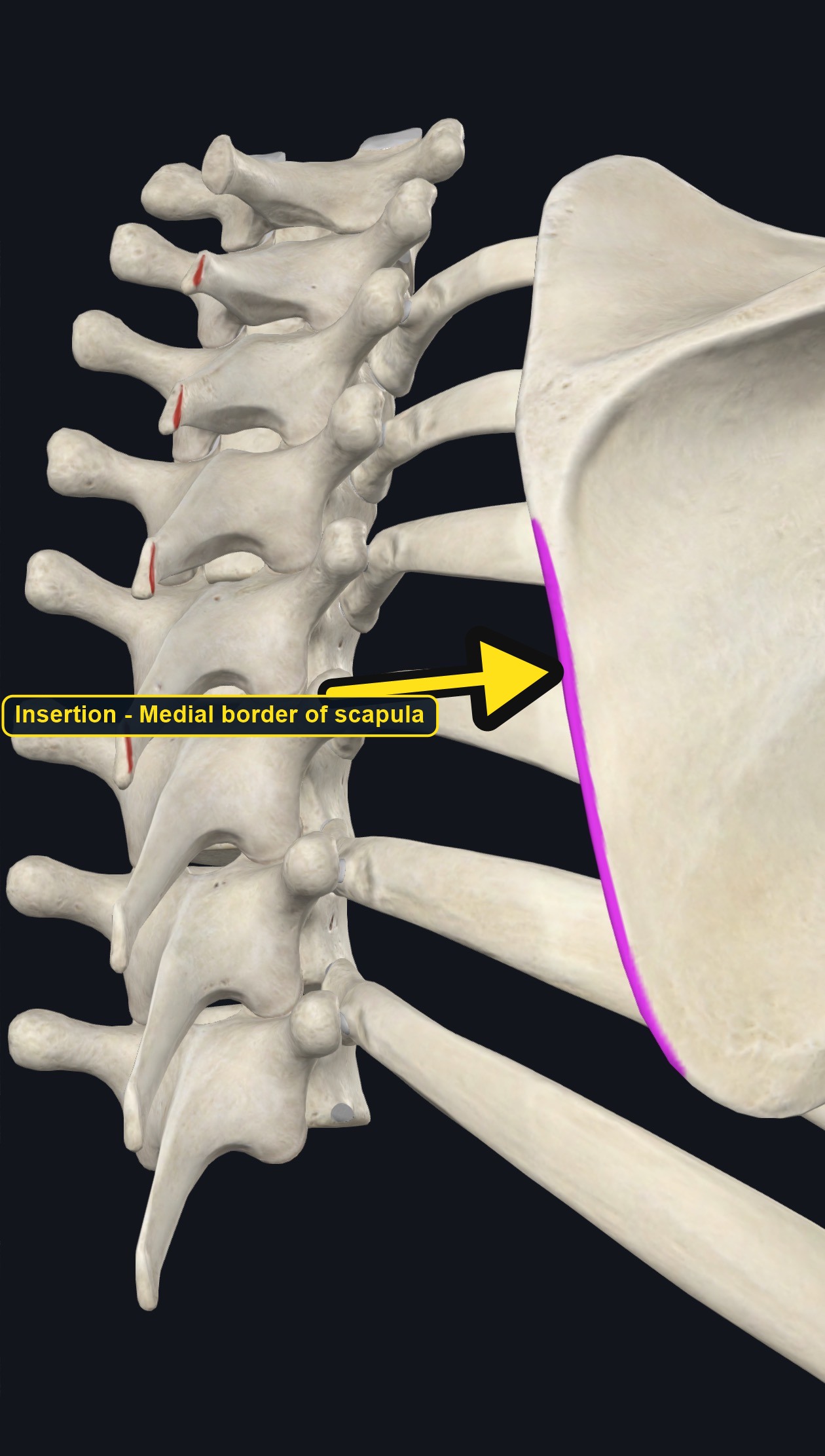 Vertebrae and scapula with the attachment sites of rhomboid major marked (arrows and labels mark the insertion)