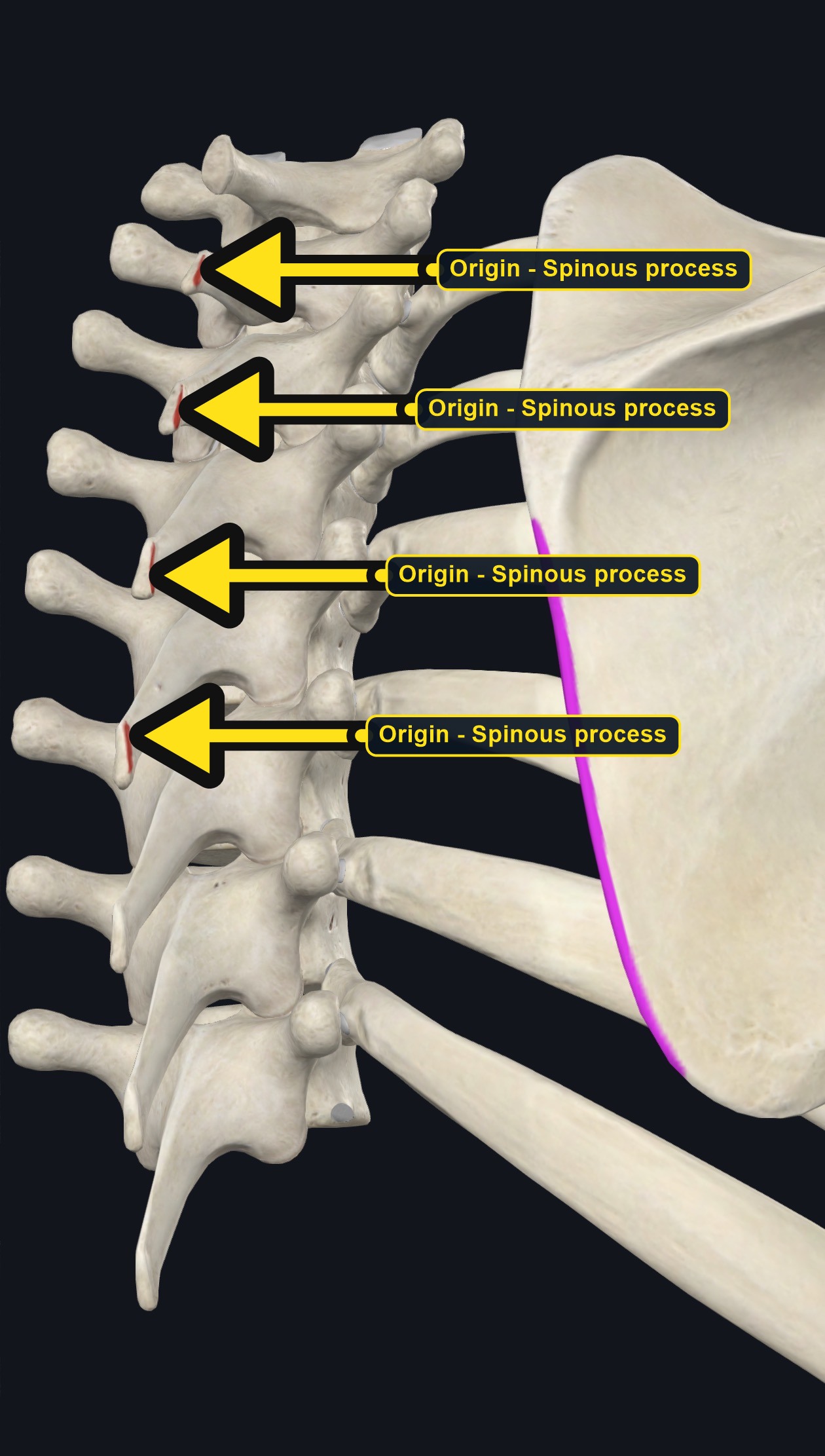 Vertebrae and scapula with the attachment sites of rhomboid major marked (arrows and labels mark the origin)