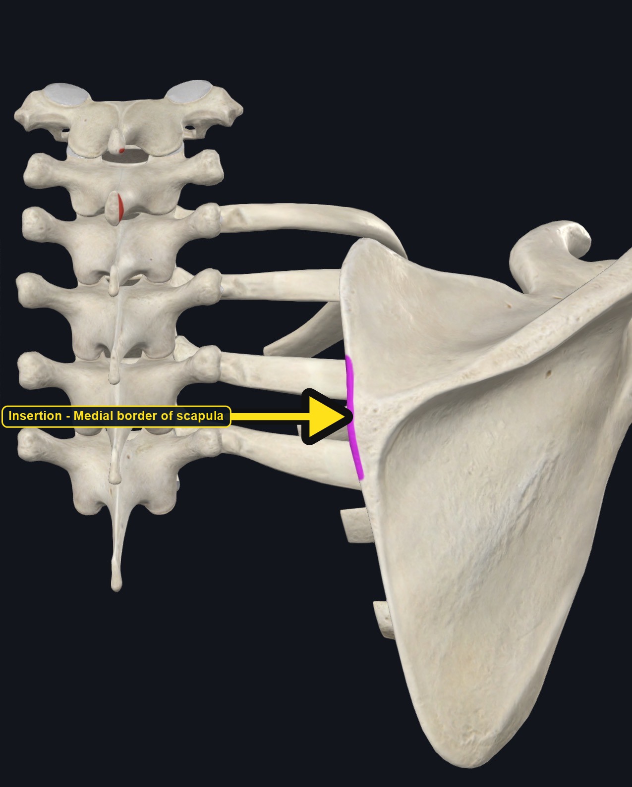 Vertebrae and scapula with the attachment sites of rhomboid minor marked (arrows and labels mark the insertion)