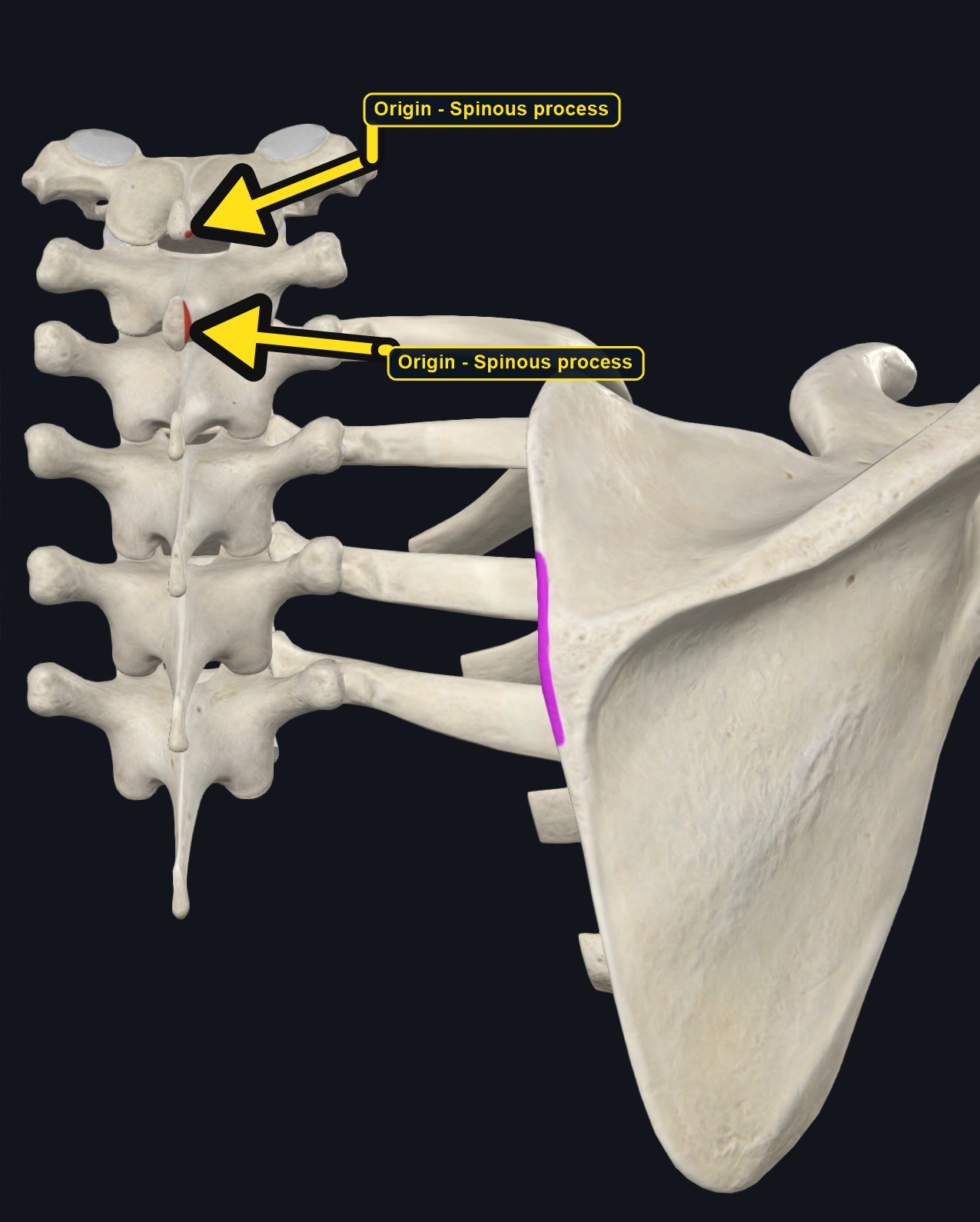 Vertebrae and scapula with the attachment sites of rhomboid minor marked (arrows and labels mark the origin)
