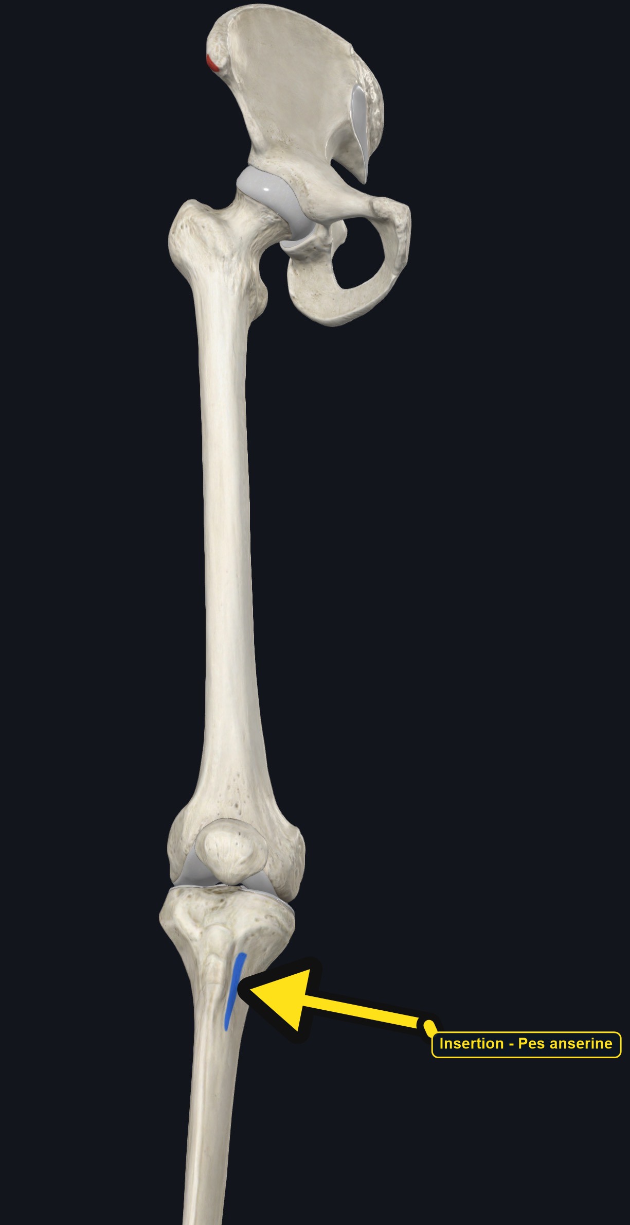 Pelvis, femur, and tibia with the attachment sites of sartorius marked (arrows and labels mark the insertion)