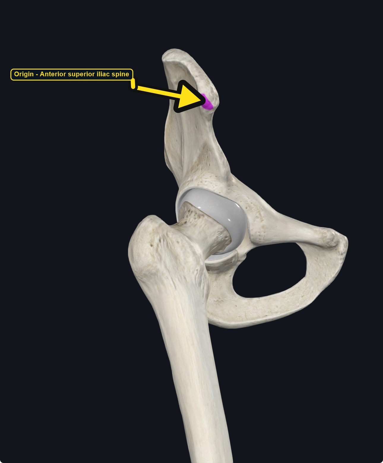 Close view of the hip bone with the origin of sartorius marked (arrows and labels mark the origin)