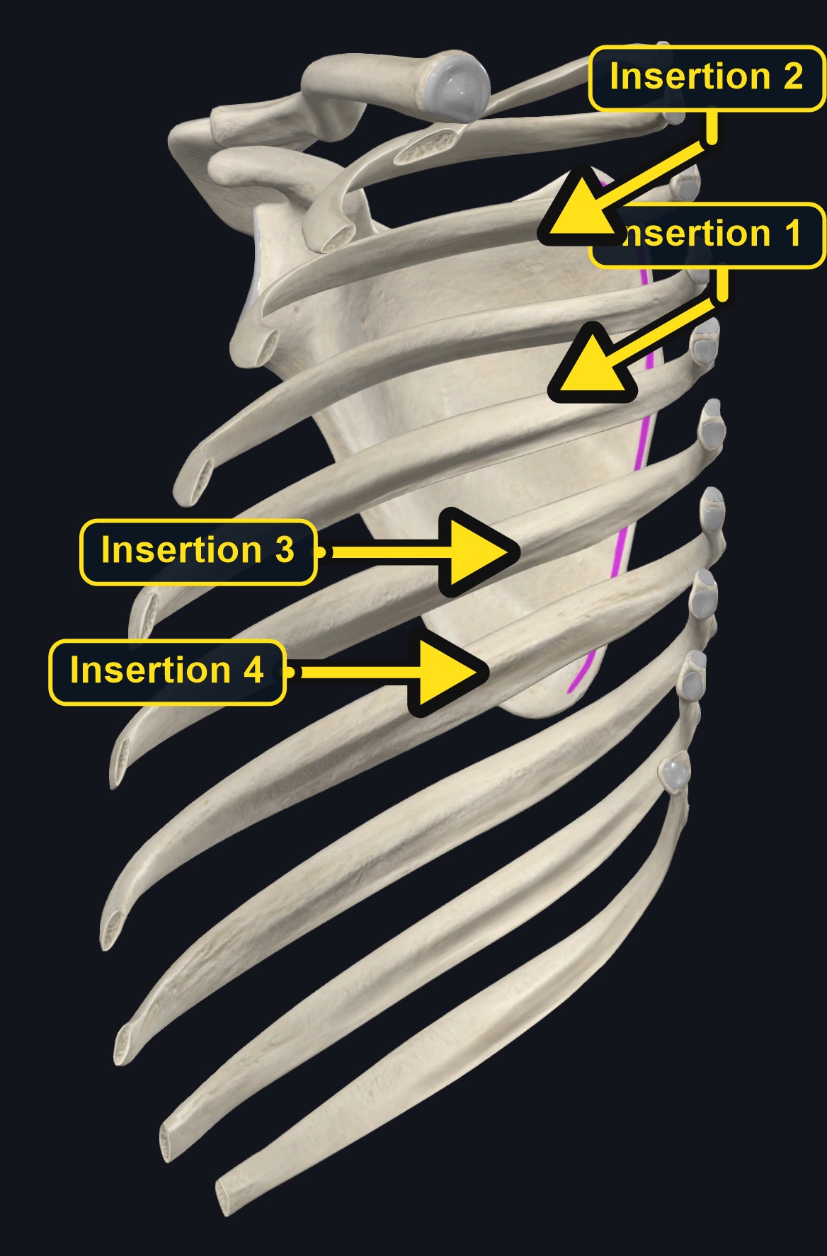 Serratus anterior scapular insertion (arrows and labels mark the insertion)