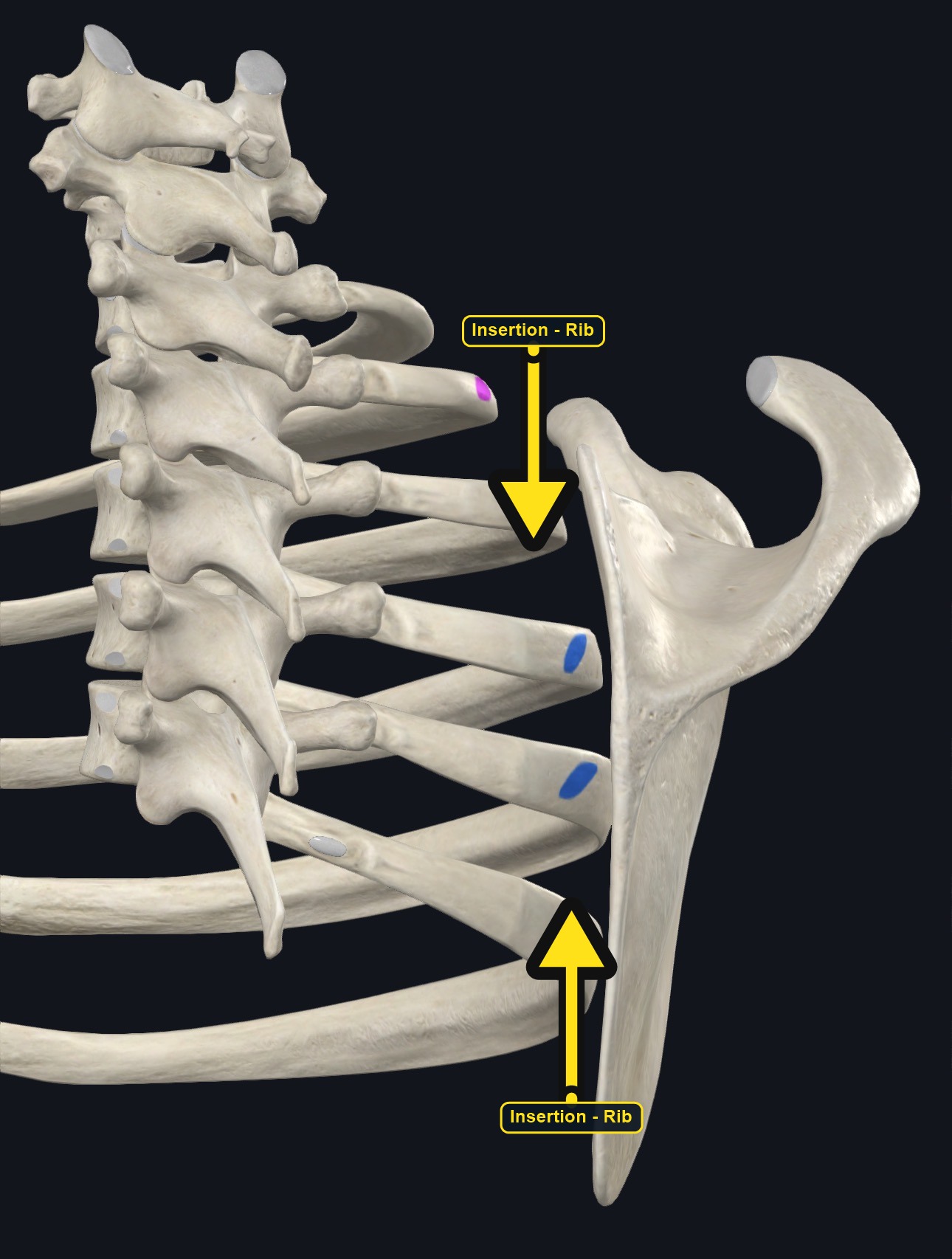 Upper ribs and spine with the attachment sites of serratus posterior superior marked (arrows and labels mark the insertion)
