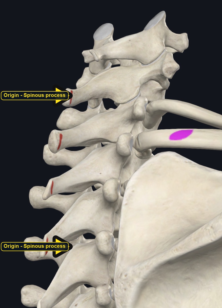 Close view of the upper ribs and spine showing the muscle's attachment points (arrows and labels mark the origin)