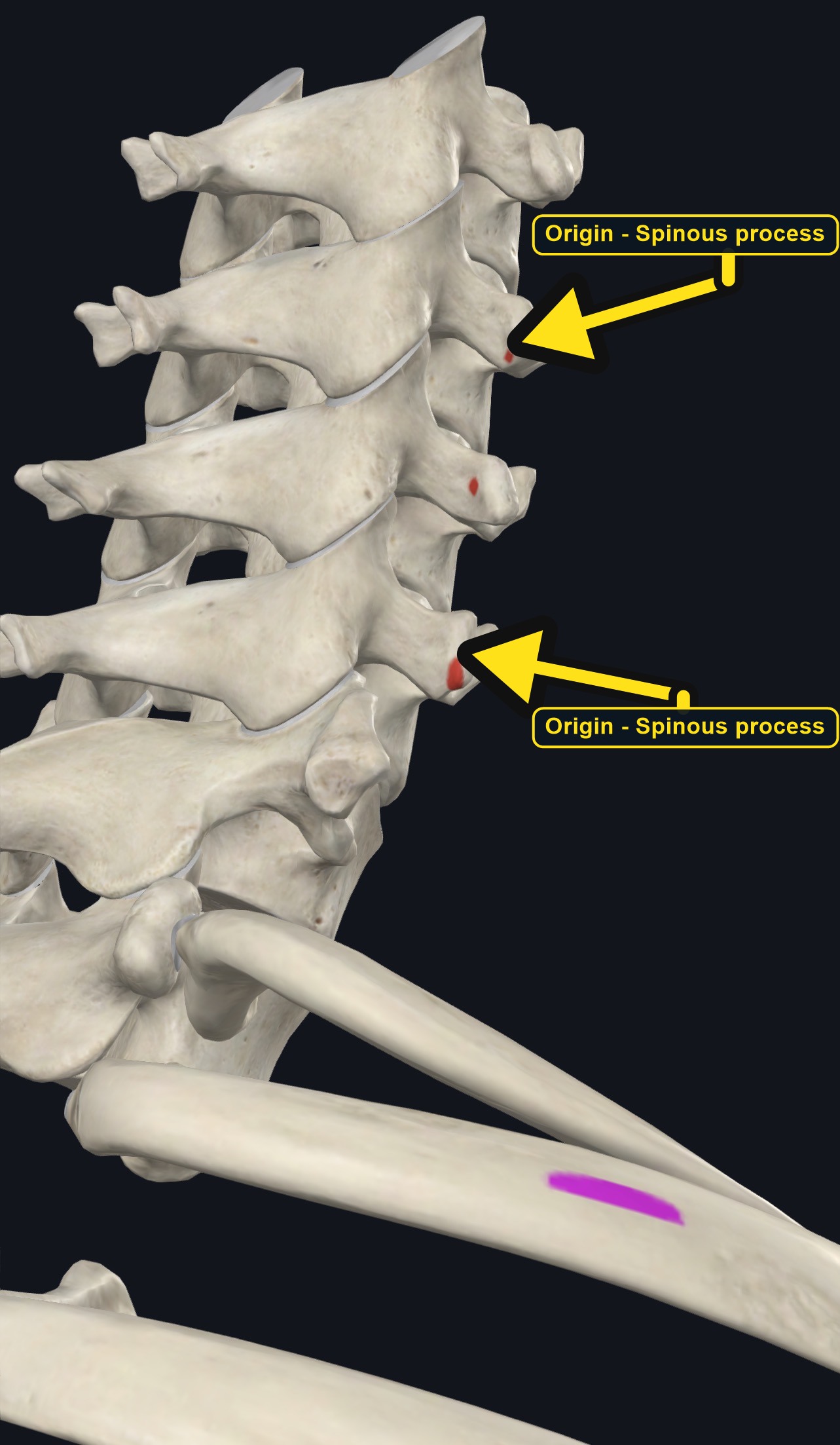 Cervical spine with the origin sites of splenius capitis marked (arrows and labels mark the origin)