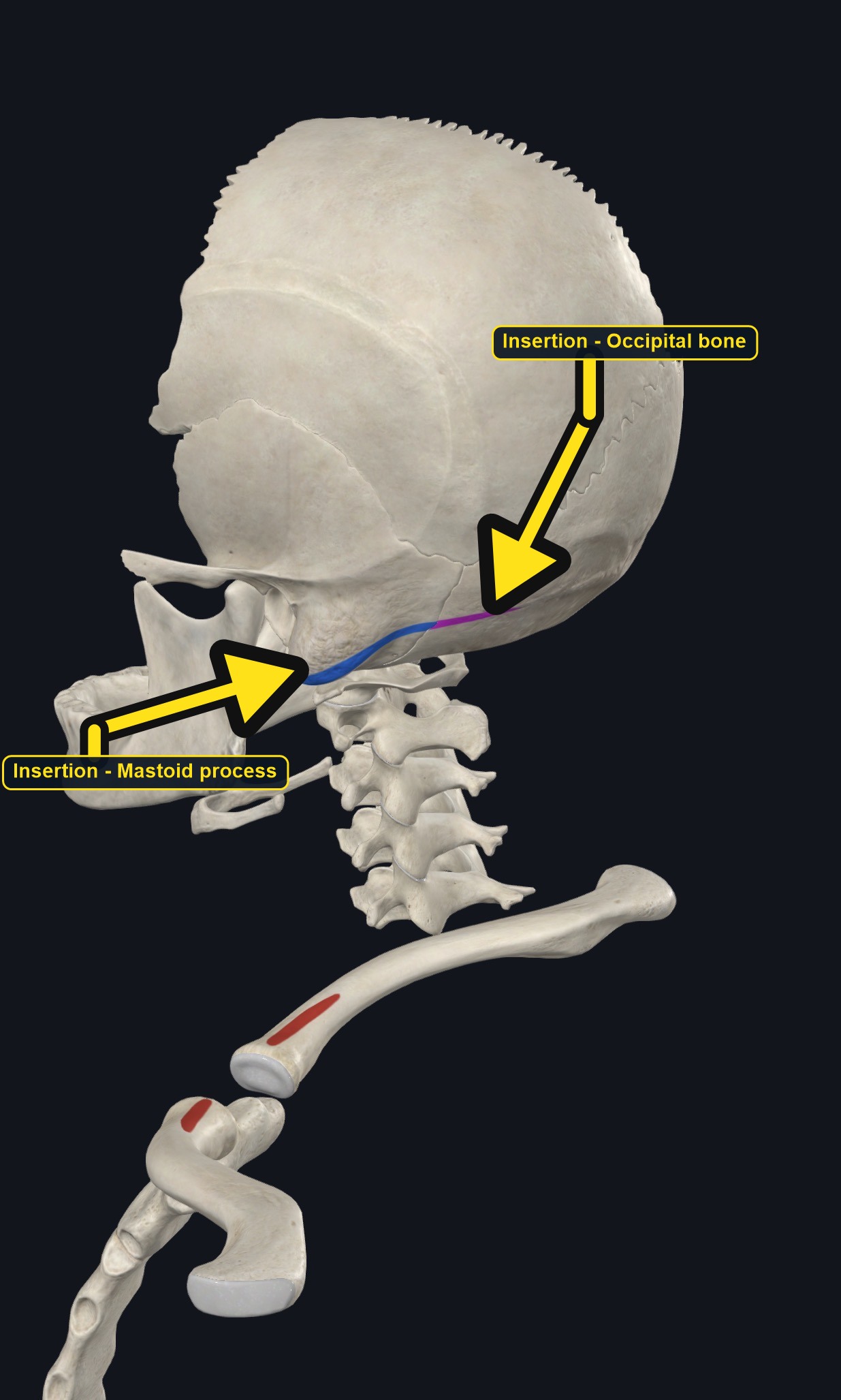 Skull, sternum, and clavicle with the attachment sites of sternocleidomastoid marked (arrows and labels mark the insertion)