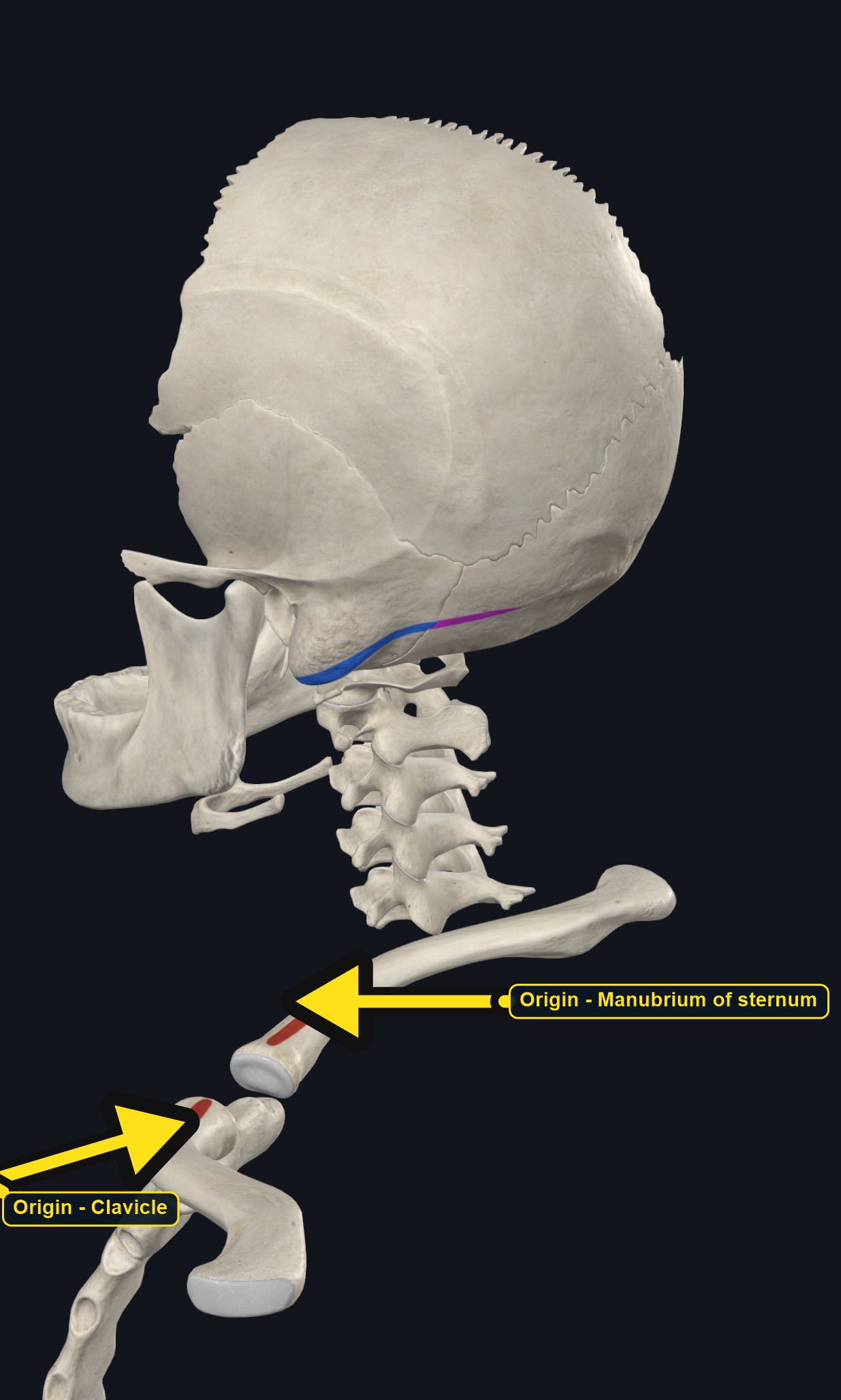 Skull, sternum, and clavicle with the attachment sites of sternocleidomastoid marked (arrows and labels mark the origin)