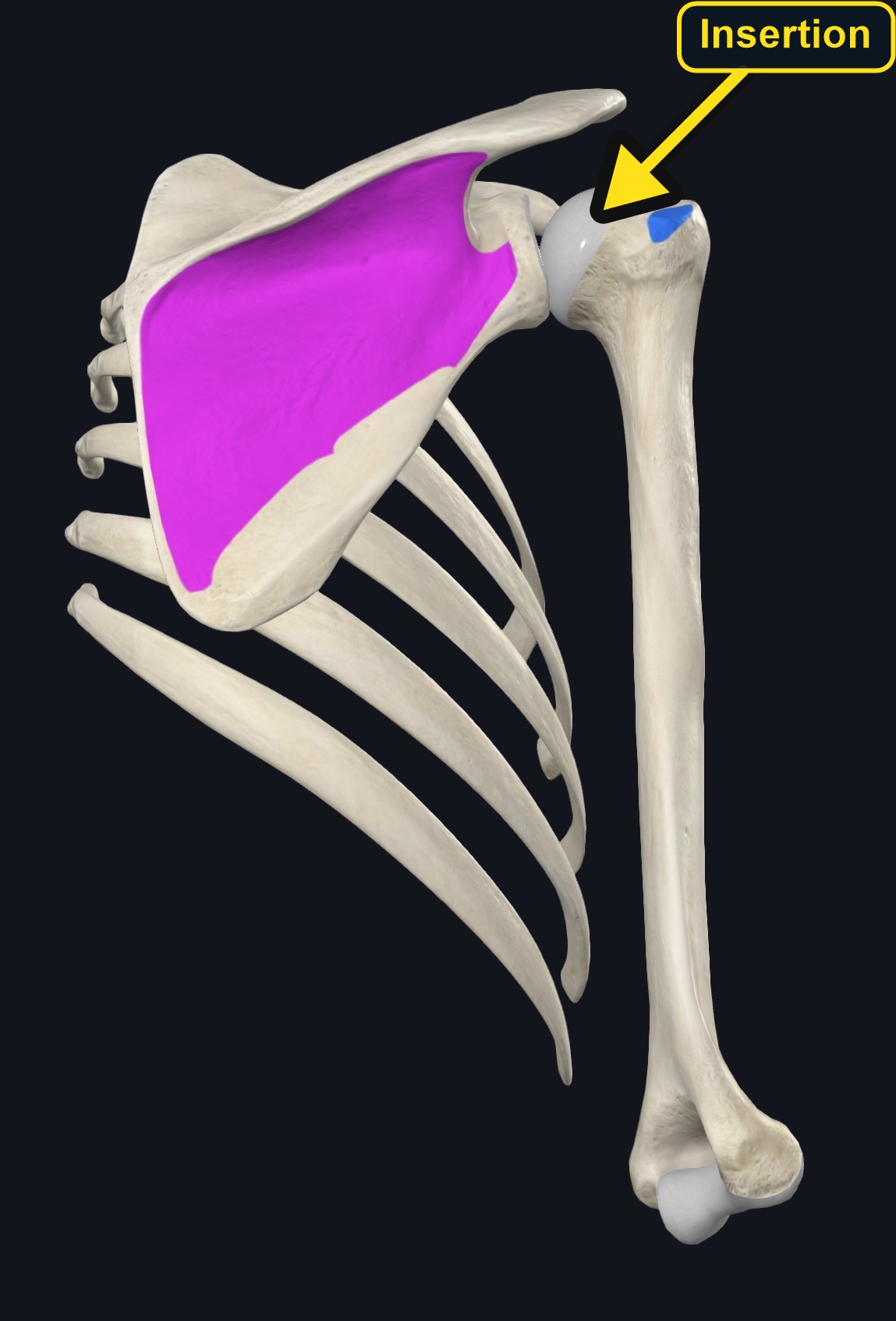 Subscapularis attachment landmarks (arrows and labels mark the insertion)