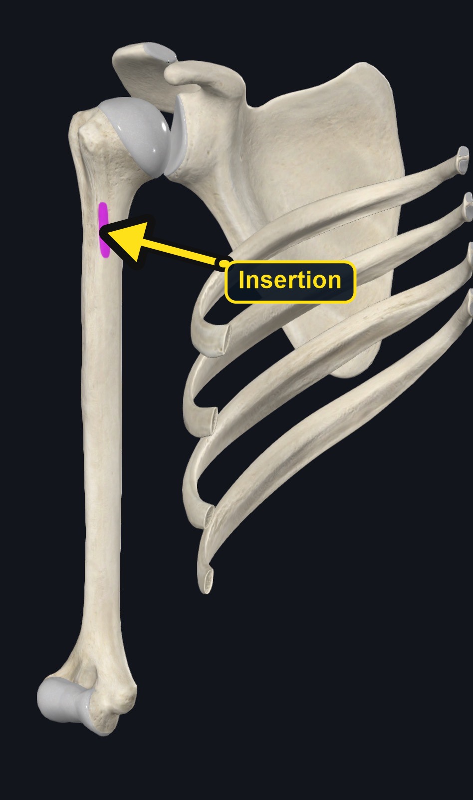 Teres major humeral insertion (arrows and labels mark the insertion)