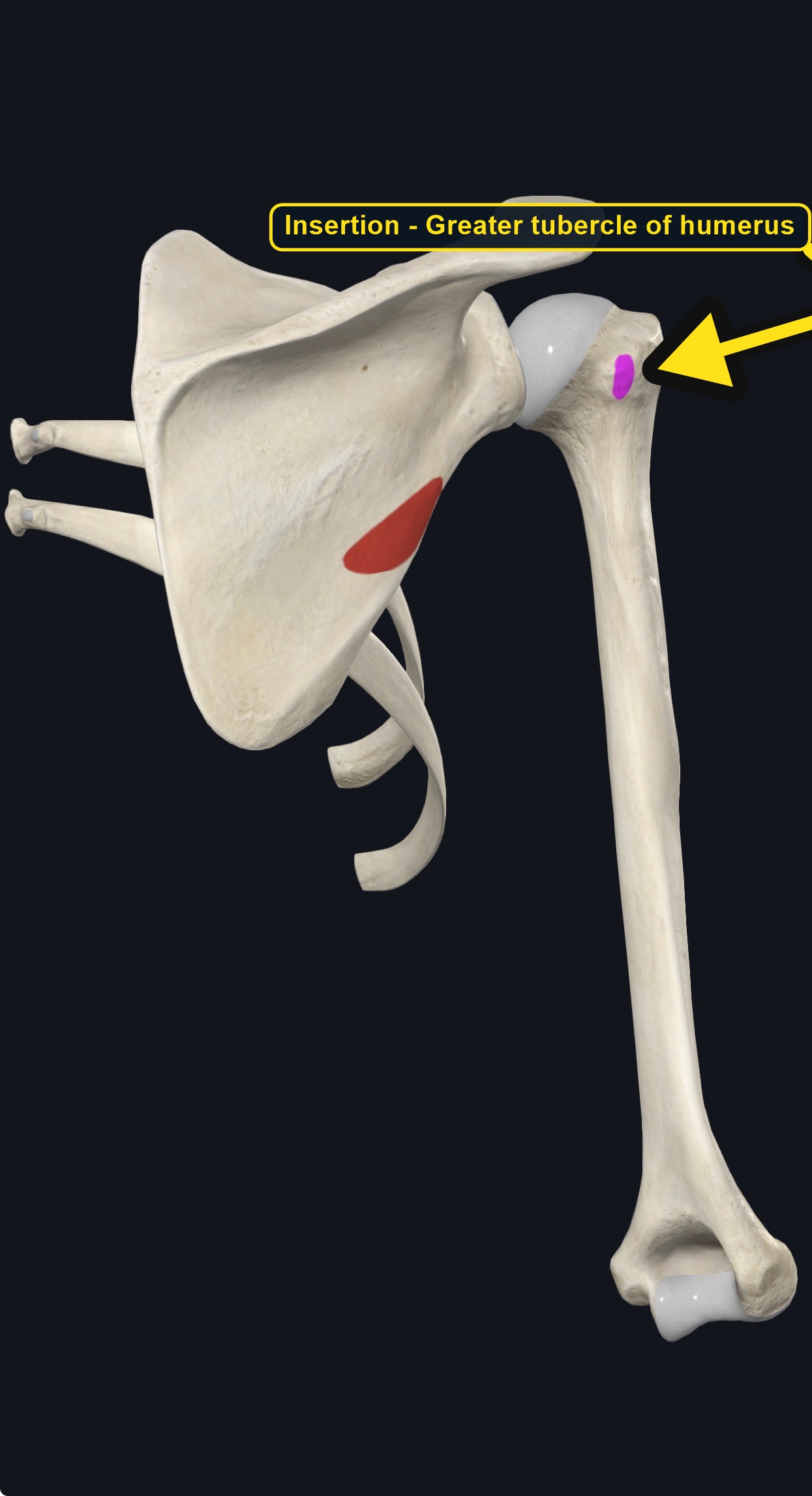 Scapula and humerus with the attachment sites of teres minor marked (arrows and labels mark the insertion)