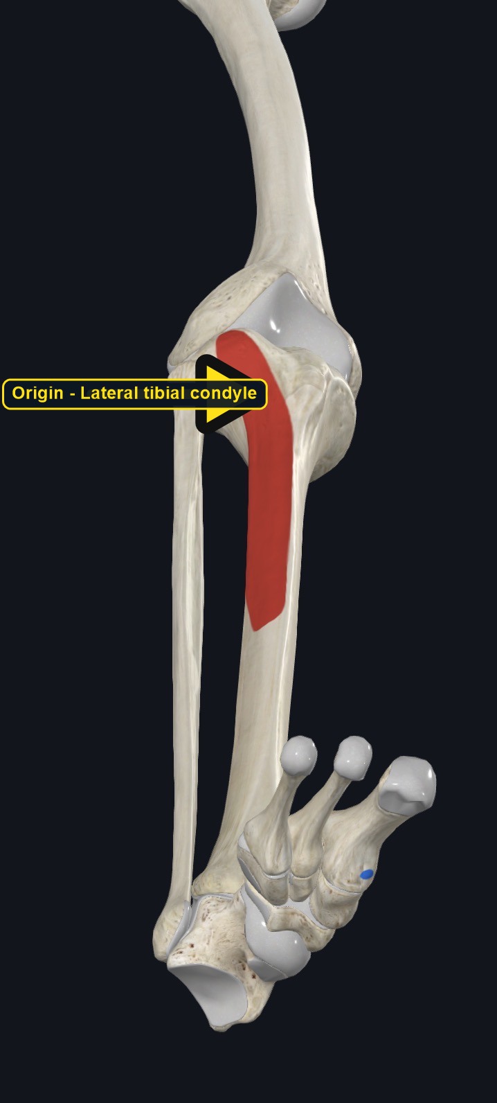 Tibia and fibula with the origin of tibialis anterior marked (arrows and labels mark the origin)