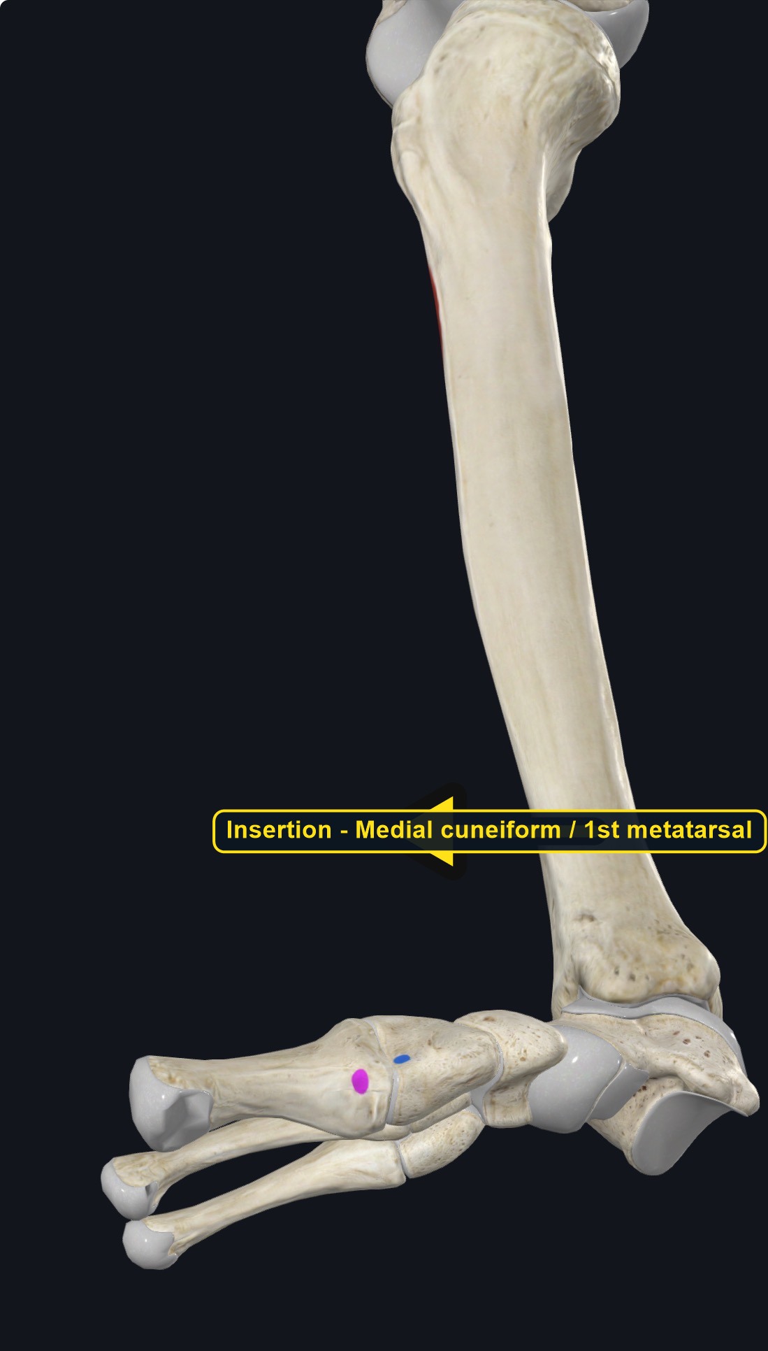 Foot bones with the insertion of tibialis anterior marked (arrows and labels mark the insertion)