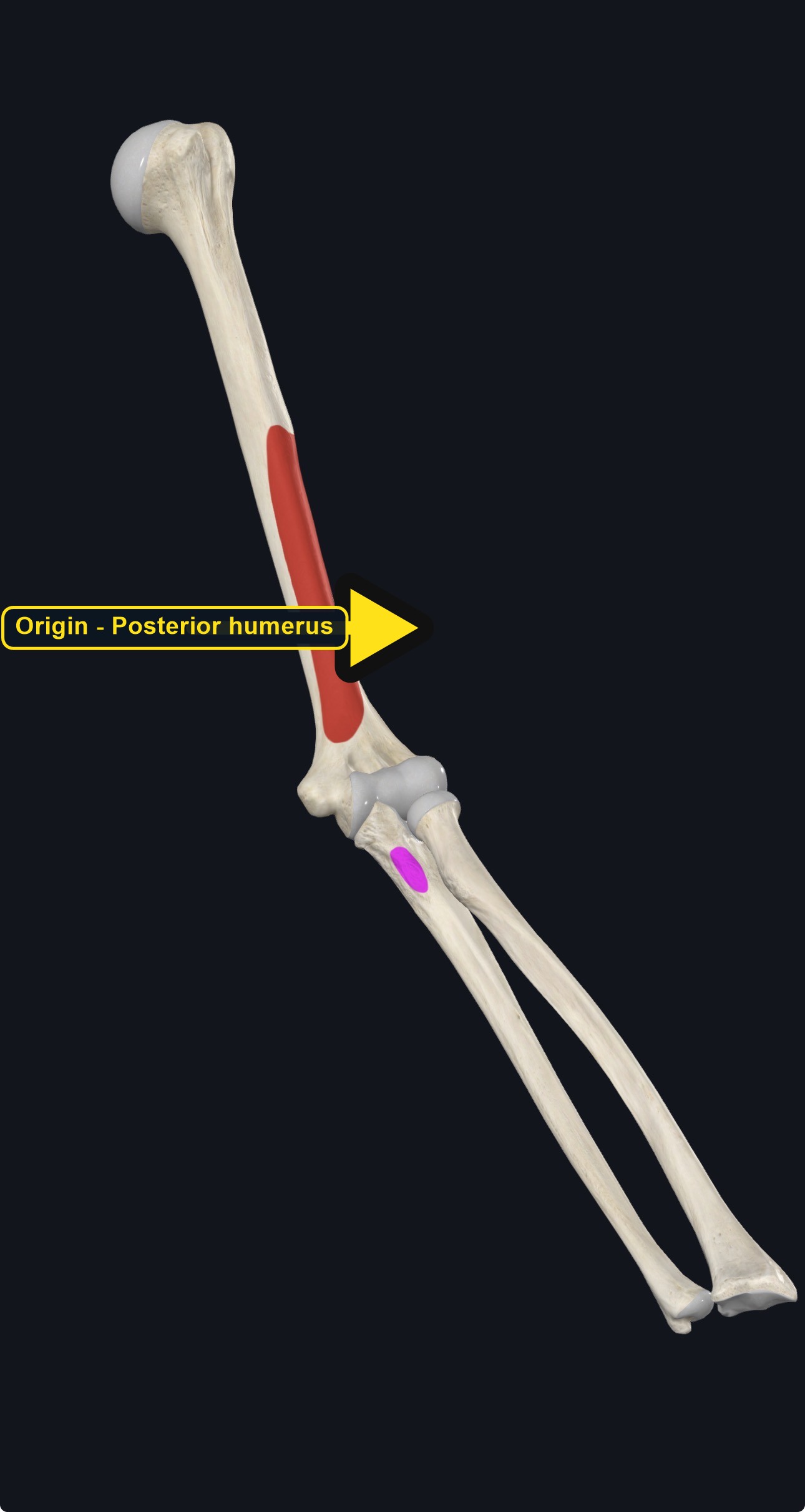 Humerus and ulna with the attachment sites of triceps brachii marked (arrows and labels mark the origin)