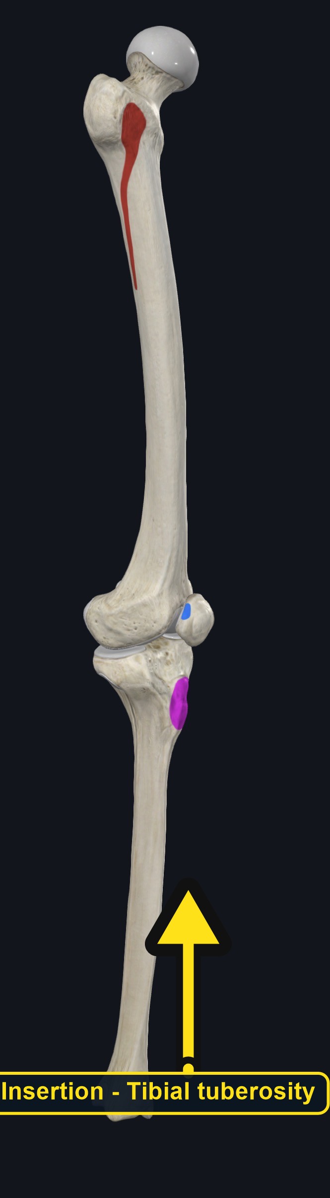 Femur and tibia with the attachment sites of vastus intermedius marked (arrows and labels mark the insertion)