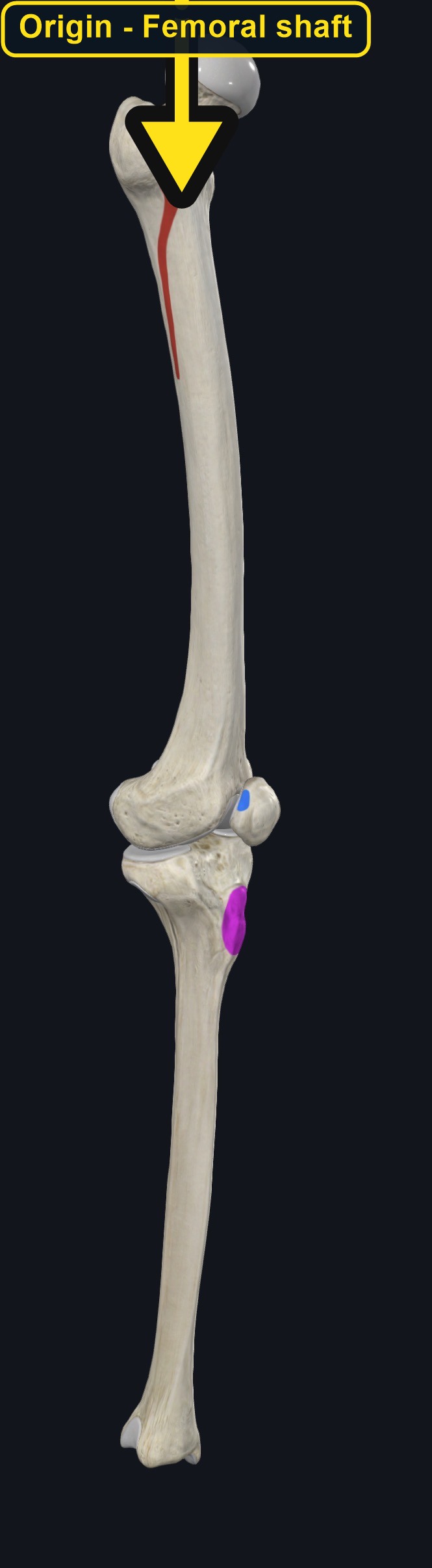 Femur and tibia with the attachment sites of vastus intermedius marked (arrows and labels mark the origin)