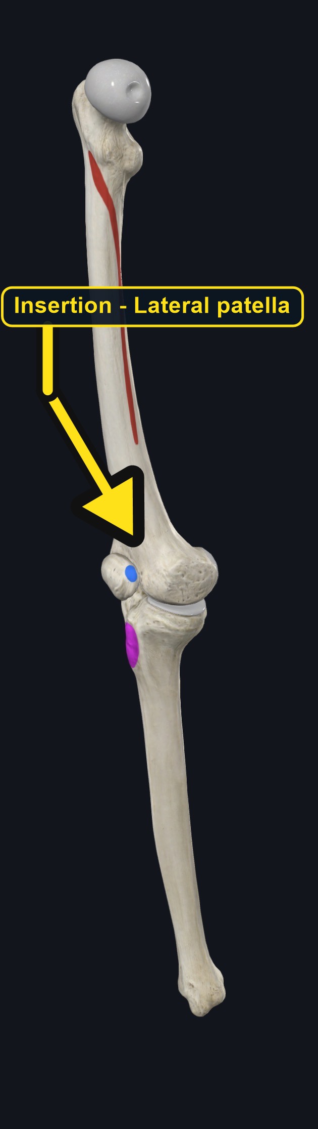 Knee with the insertion of vastus lateralis marked (arrows and labels mark the insertion)