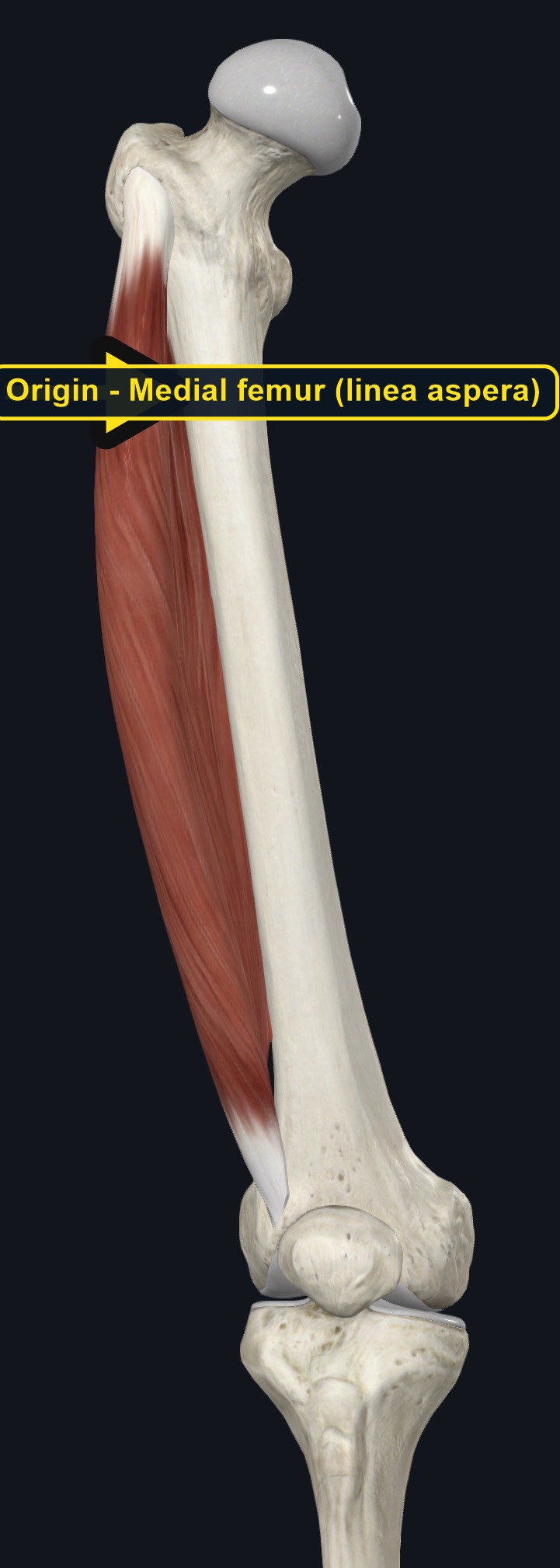 Femur and knee with the origin and insertion of vastus medialis marked (arrows and labels mark the origin)