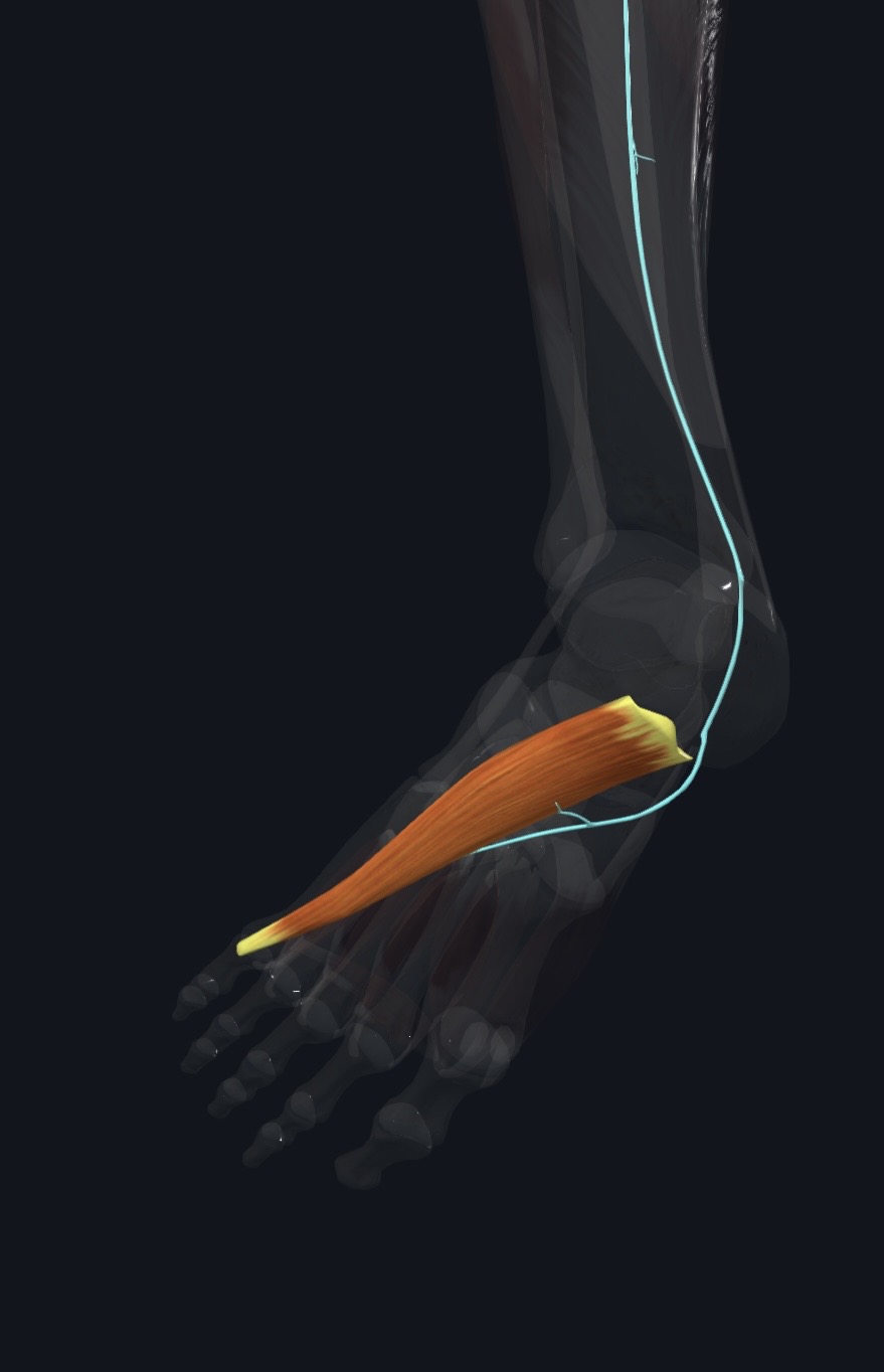 Abductor hallucis on the medial foot with its nerve