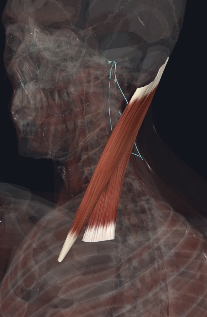 Sternocleidomastoid with the nerve that supplies it