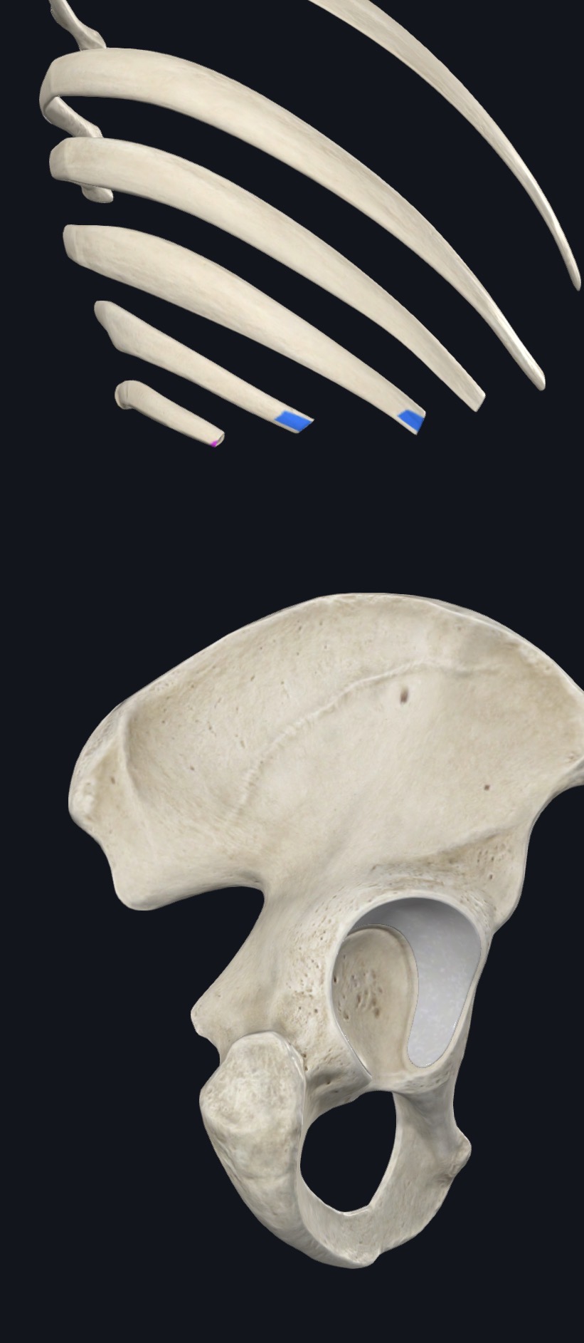 Lower ribs with the costal cartilage origin sites of transversus abdominis marked